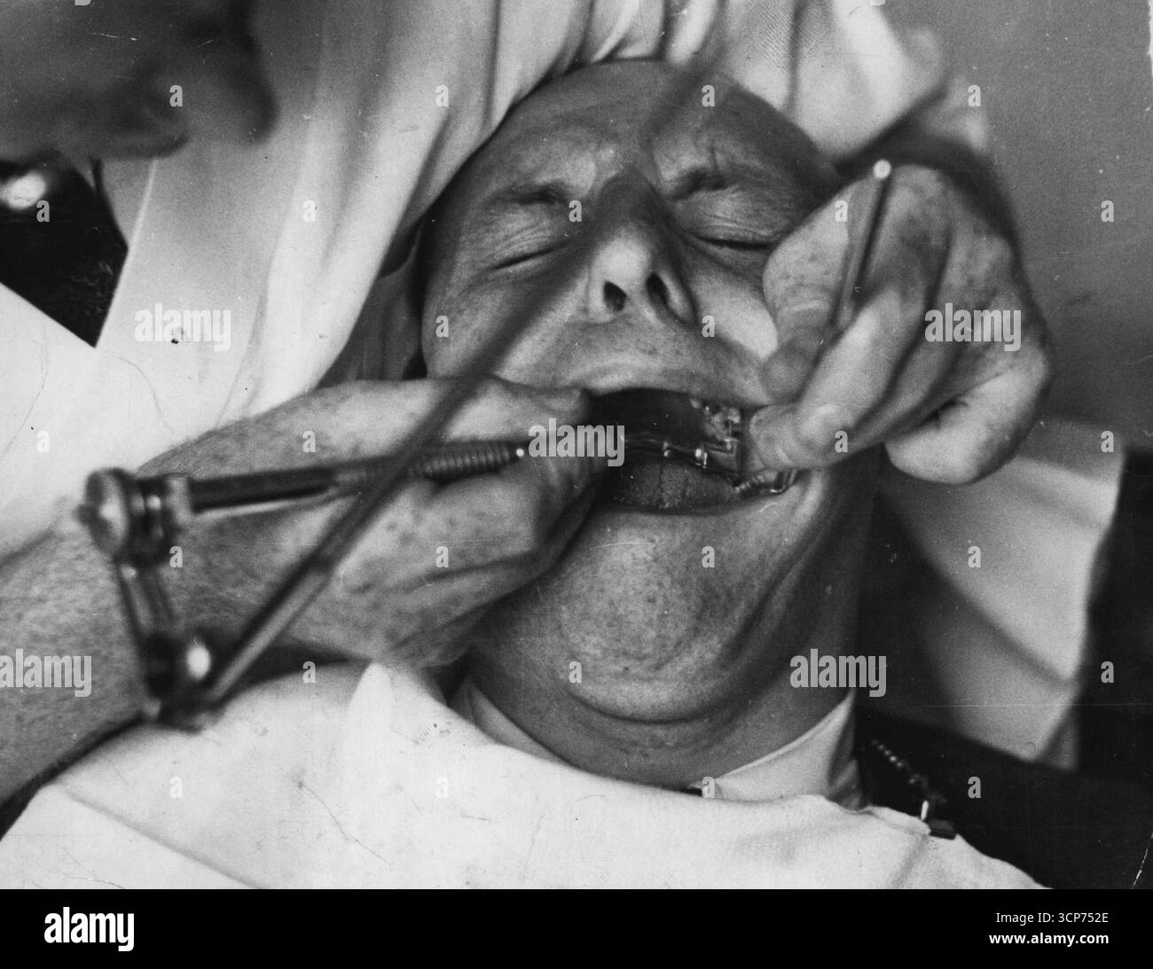E ha pagato per farlo. Tutte le torture umane non sono finite con il Medioevo, E.K. Butler impara, ancora una volta, mentre il suo dentista scende a letto. Sono stati volti come questo che hanno spinto i dentisti all'invenzione del nuovo desensibilizzante che il paziente sorride mentre il dentista accelera con il trivellante. 27 luglio 1937. (Foto di Associated Press Photo). Foto Stock