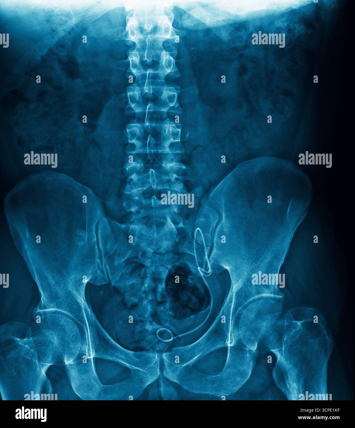 Radiografia della colonna lombare e del bacino che mostra ossa e articolazioni con dettaglio medico. Pellicola radiologica della colonna vertebrale inferiore con struttura ossea e allineamento visibili Foto Stock