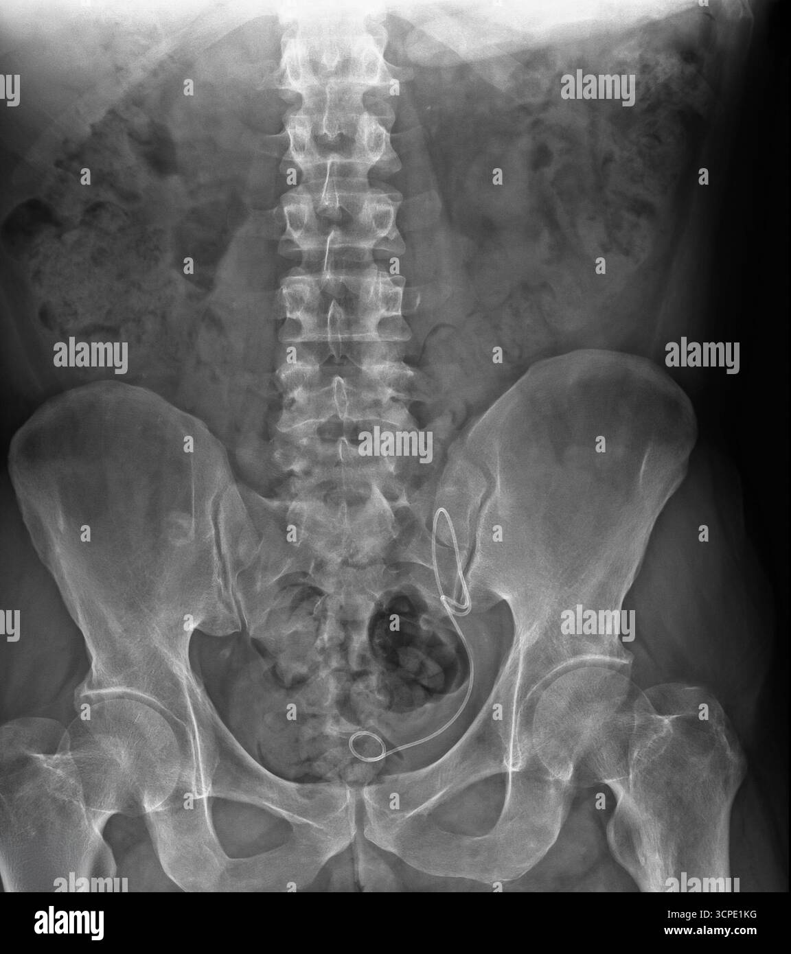 Radiografia della colonna lombare e del bacino che mostra ossa e articolazioni con dettaglio medico. Pellicola radiologica della colonna vertebrale inferiore con struttura ossea e allineamento visibili Foto Stock