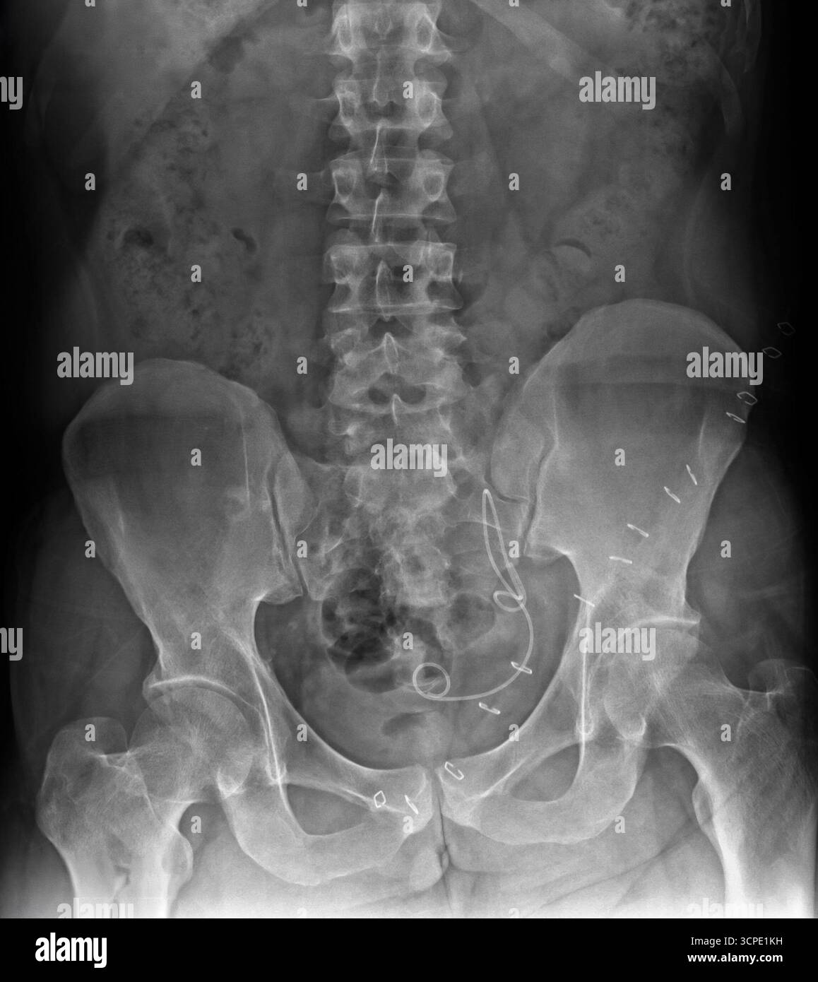 Radiografia della colonna lombare e del bacino che mostra ossa e articolazioni con dettaglio medico. Pellicola radiologica della colonna vertebrale inferiore con struttura ossea e allineamento visibili Foto Stock