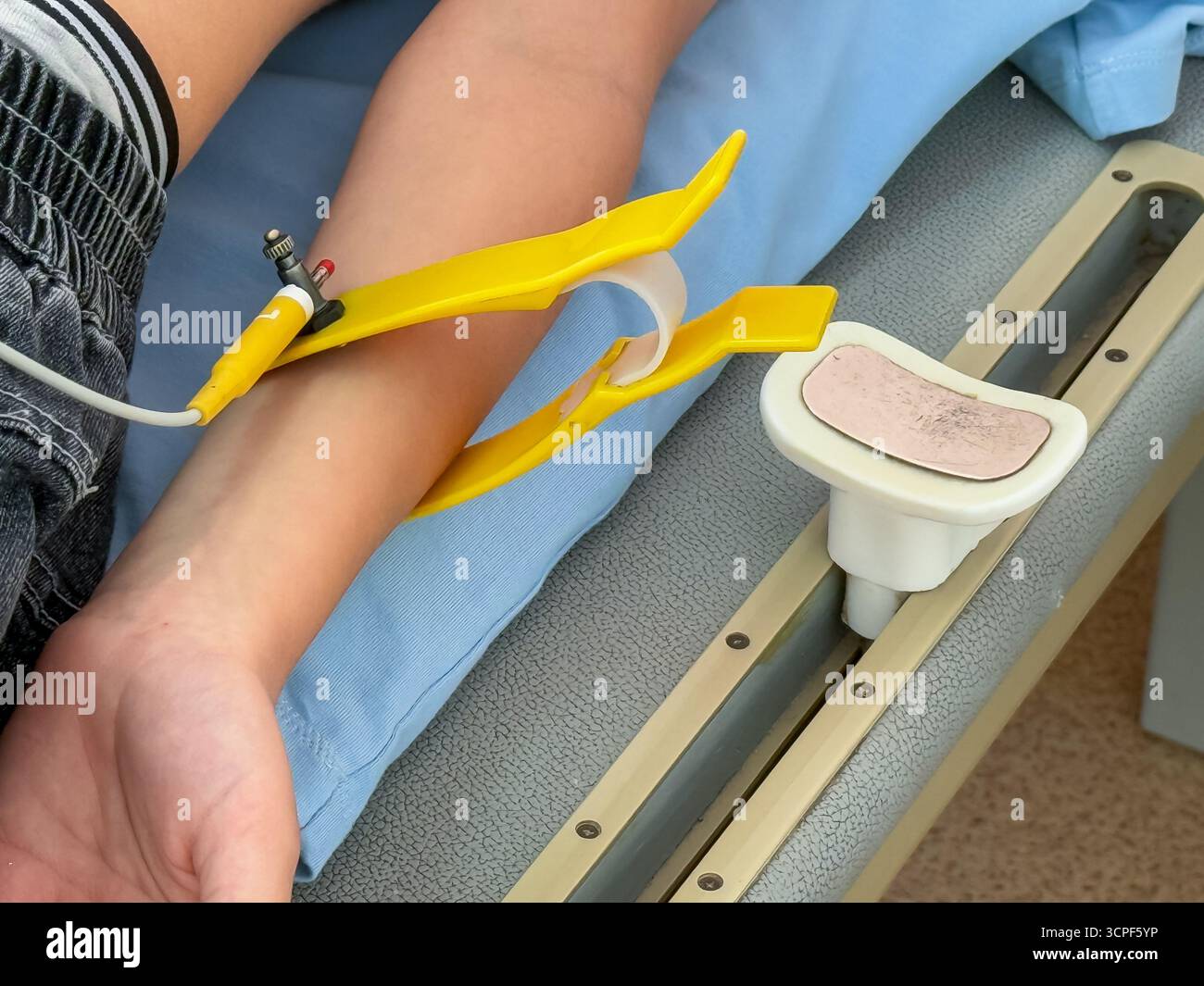 Primo piano della mano di un bambino con elettrodi ECG applicati per il monitoraggio cardiaco in ambiente medico - Immagine stock catturata con smartphone