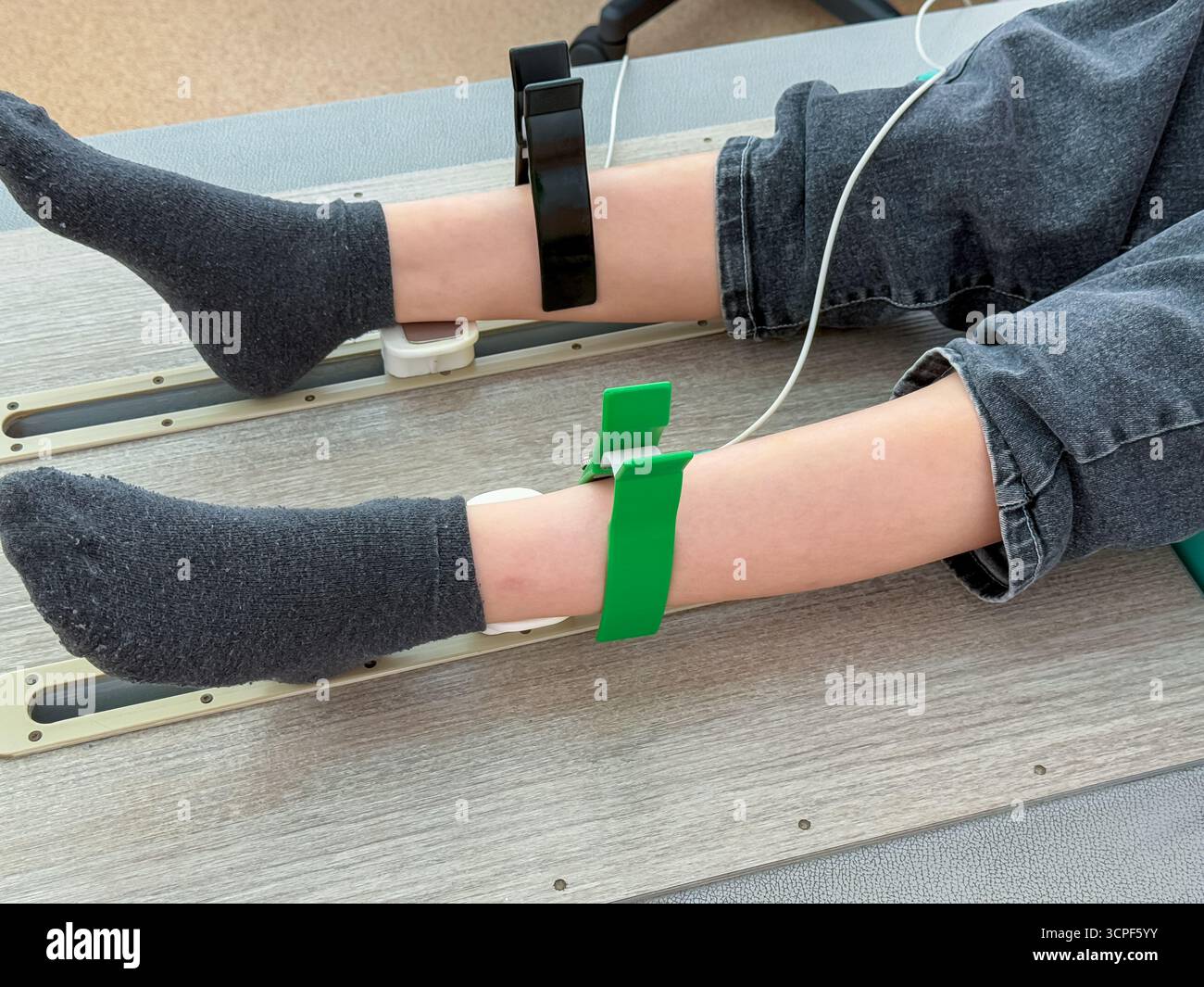 Primo piano delle gambe del bambino con clip per elettrodi ECG attaccate durante l'esame diagnostico per la salute del cuore in clinica - Immagine stock catturata con smartphone