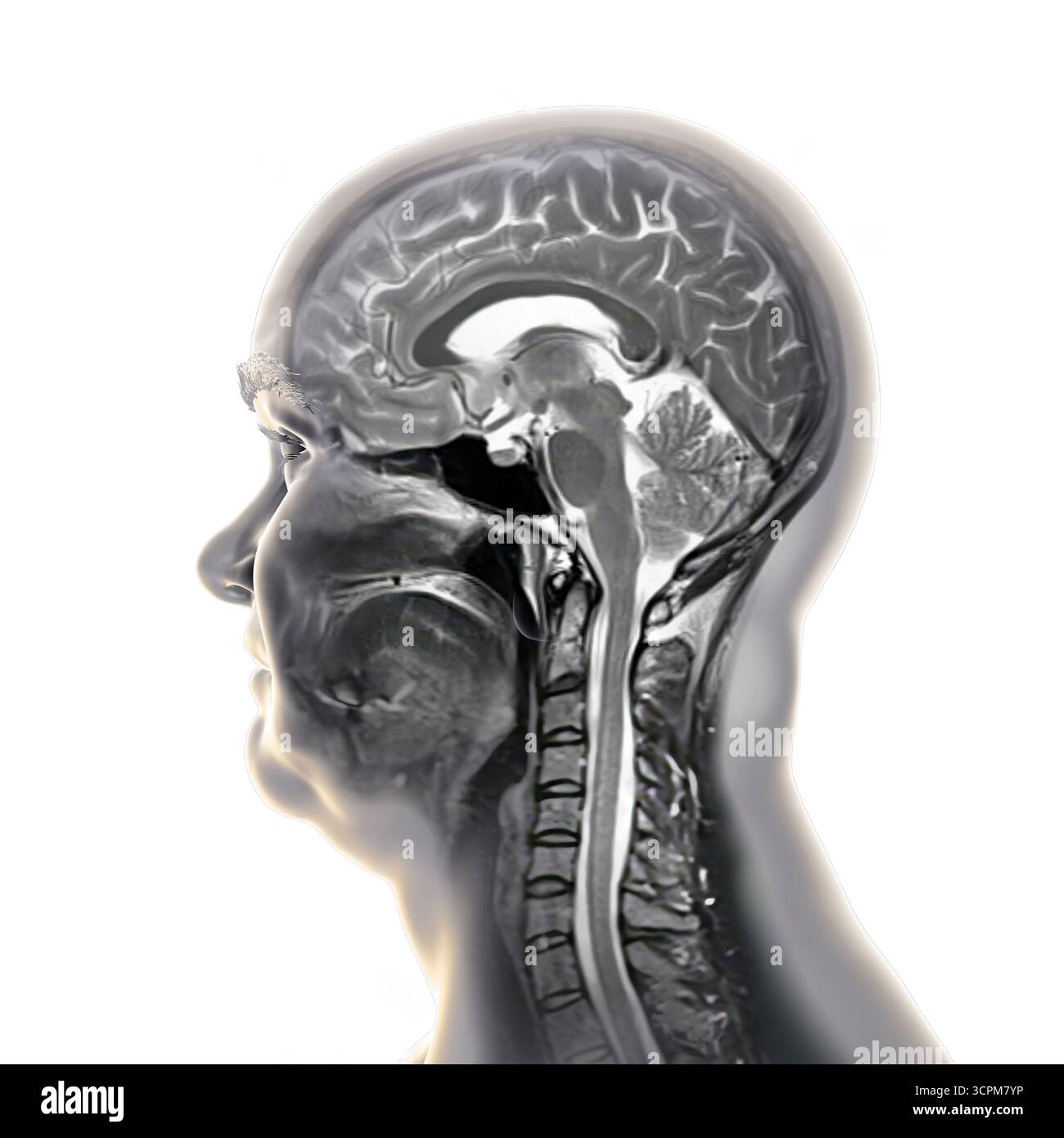 Immagine di una scansione a risonanza magnetica colorata (MRI) del cervello e del collo, che mostra l'anatomia del sistema nervoso centrale e la colonna cervicale. Foto Stock