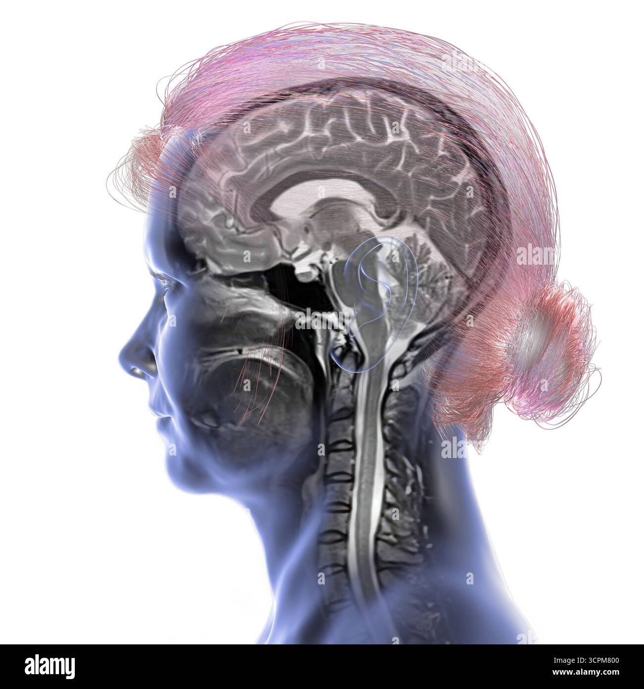Immagine di una scansione a risonanza magnetica colorata (MRI) del cervello e del collo, che mostra l'anatomia del sistema nervoso centrale e la colonna cervicale. Foto Stock