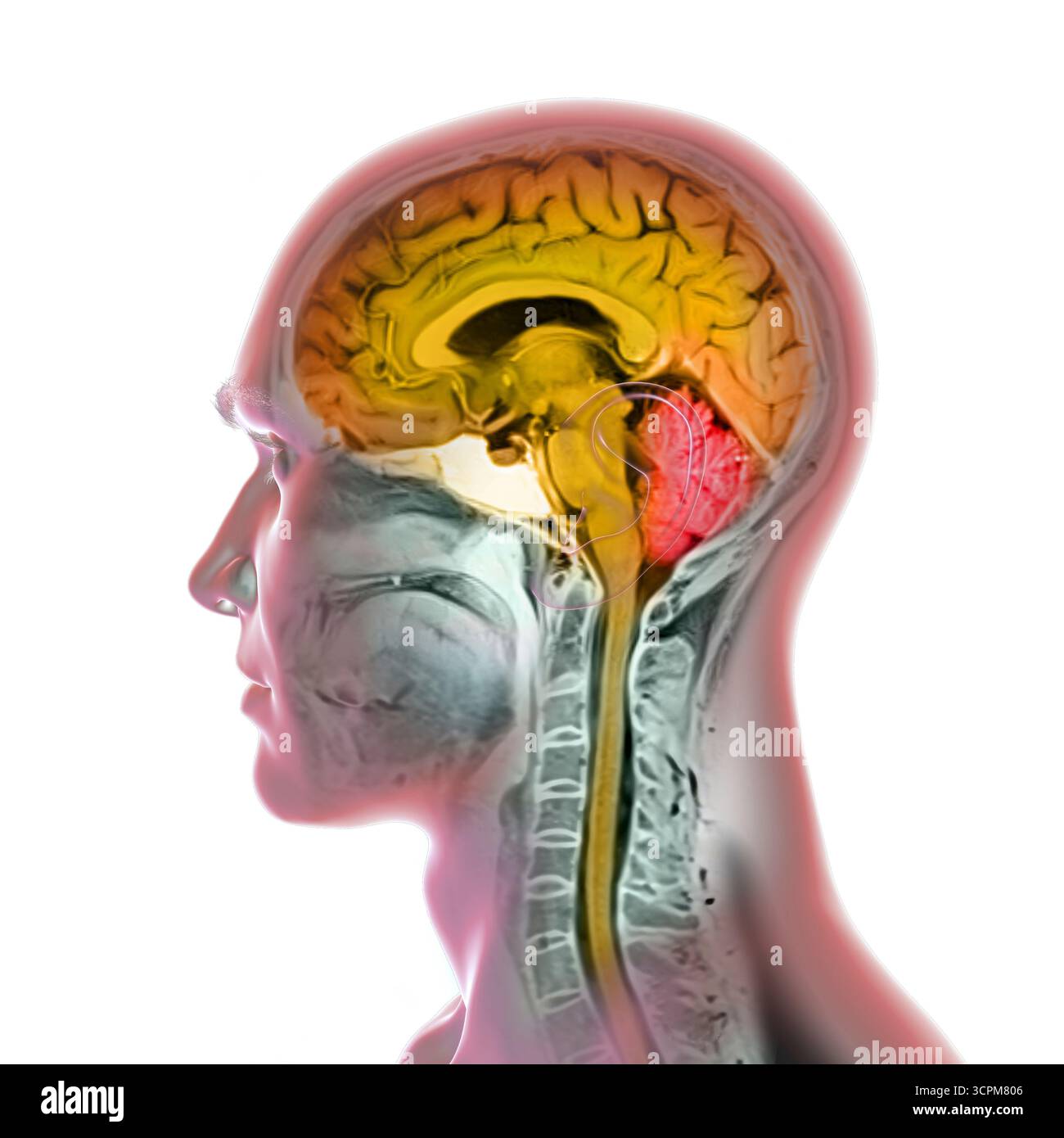 Immagine di una scansione a risonanza magnetica colorata (MRI) del cervello e del collo, che mostra l'anatomia del sistema nervoso centrale e la colonna cervicale. Foto Stock