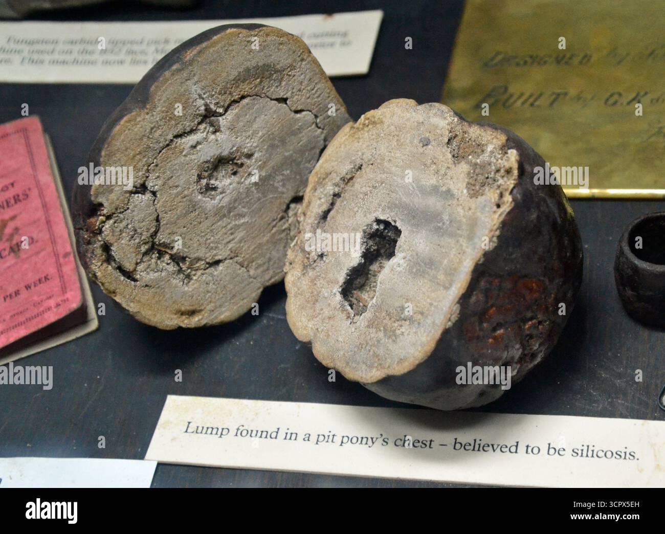 Nodulo trovato nel petto di un pony a pozzo che si crede sia silicosi, a causa della respirazione della polvere di carbone. Cyfarthfa Castle Museum & Art Gallery, Merthyr Tydfil, Galles del Sud Foto Stock