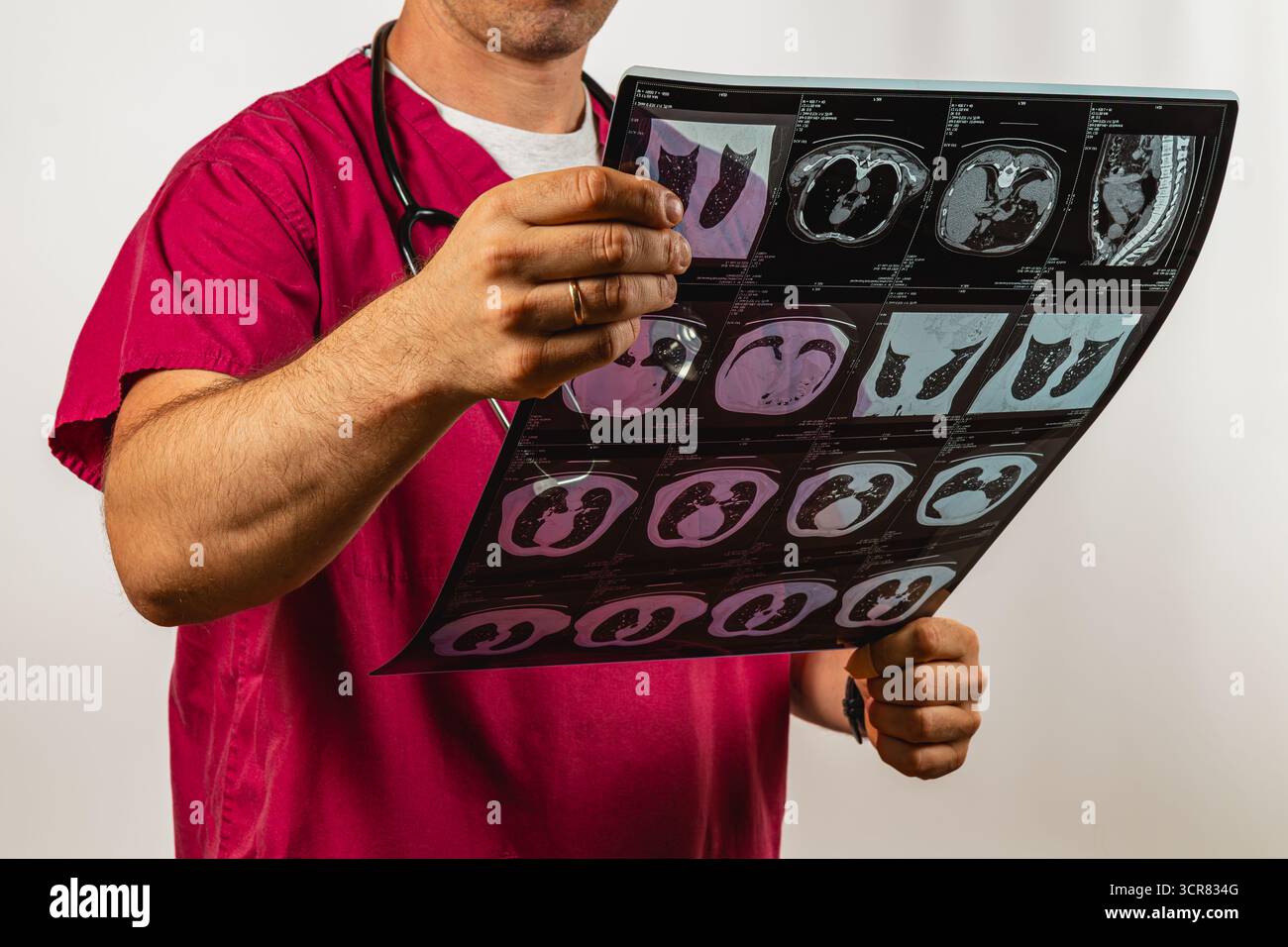 Un operatore sanitario in scrub studia attentamente le scansioni toraciche, analizzando le immagini mediche per la diagnosi del paziente in un ambiente clinico. Foto Stock