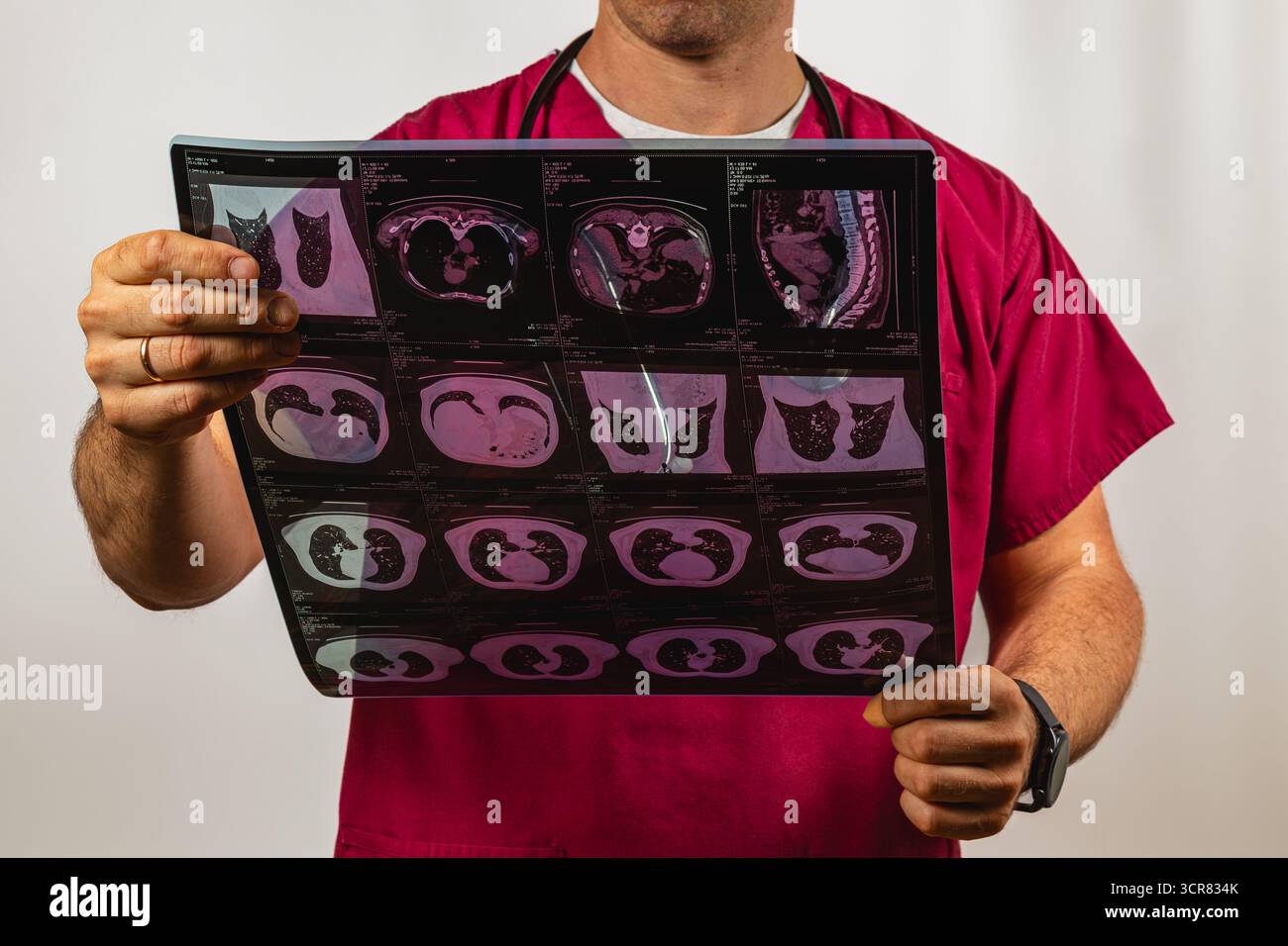 Un operatore sanitario in scrub studia immagini mediche, mostrando un'analisi focalizzata. L'ambiente suggerisce un ospedale o una clinica durante il giorno oper Foto Stock