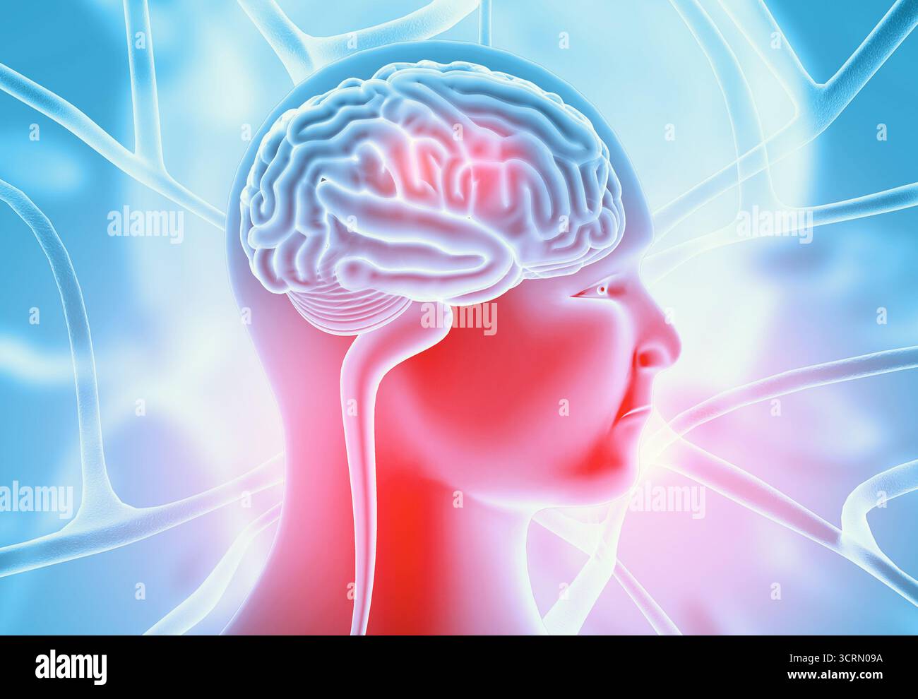 Cocnept di malattie cerebrali umane. illustrazione 3d. Foto Stock