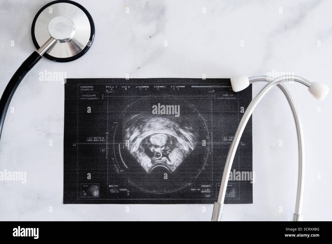 Baviera, Germania - 3 ottobre 2025: Immagine ecografica con feto, incorniciata da due stetoscopi. Foto simbolica di gravidanza, screening e medicina prenatale *** Ultraschallbild mit Fötus, eingerahmt von zwei Stethoskopen. Symbolfoto zu Schwangerschaft, Vorsorgeuntersuchung und pränataler Medizin Foto Stock