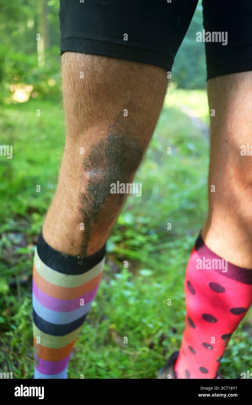 Gamba di un atleta fangosa con un pascolamento al ginocchio e calze colorate all'aperto Foto Stock