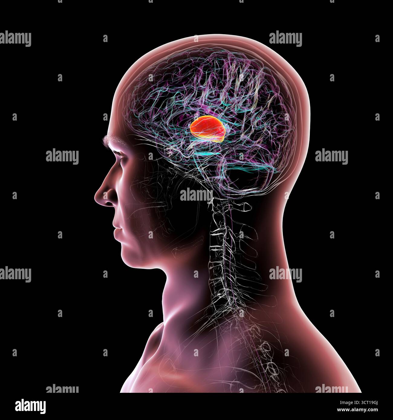 Illustrazione di un cervello umano con talamo evidenziato (rosso), che mostra le strutture di materia grigia profonda accoppiata che trasmettono i segnali sensoriali e motori alla corteccia cerebrale. Foto Stock