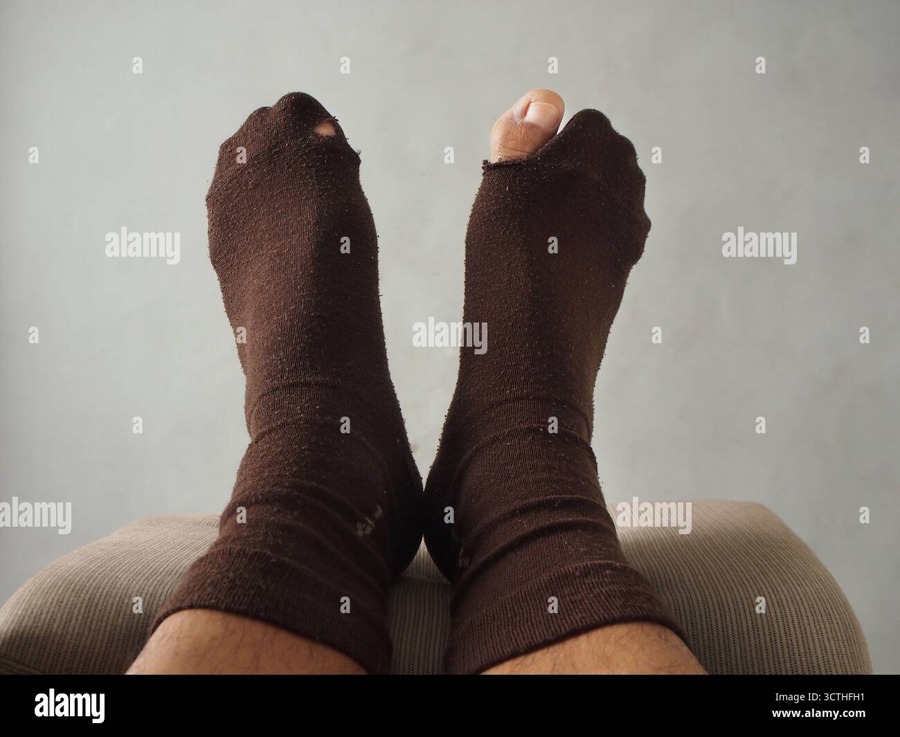 Un paio di piedi con calzini marroni con un foro nella punta grande Foto Stock