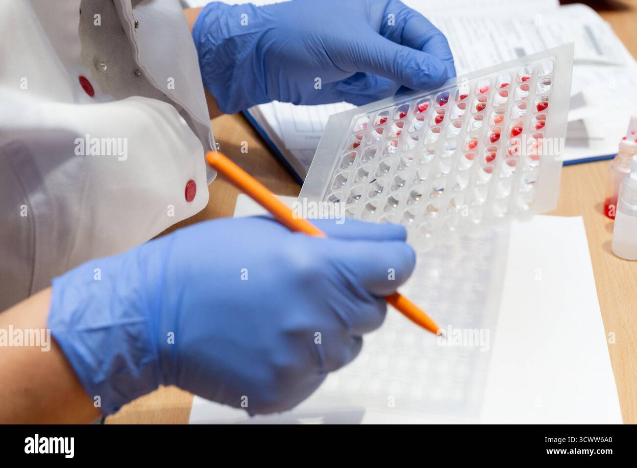 Il terapeuta utilizza la tavolozza dei campioni di sangue e le sostanze chimiche per il rilevamento del tipo di sangue Foto Stock