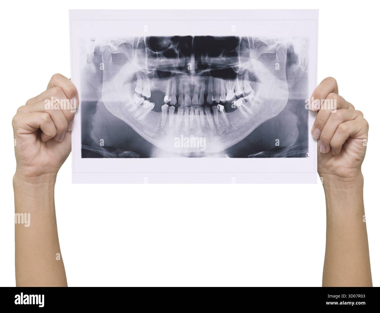 Skan panoramico a raggi X in mani umane isolato su sfondo bianco Foto Stock
