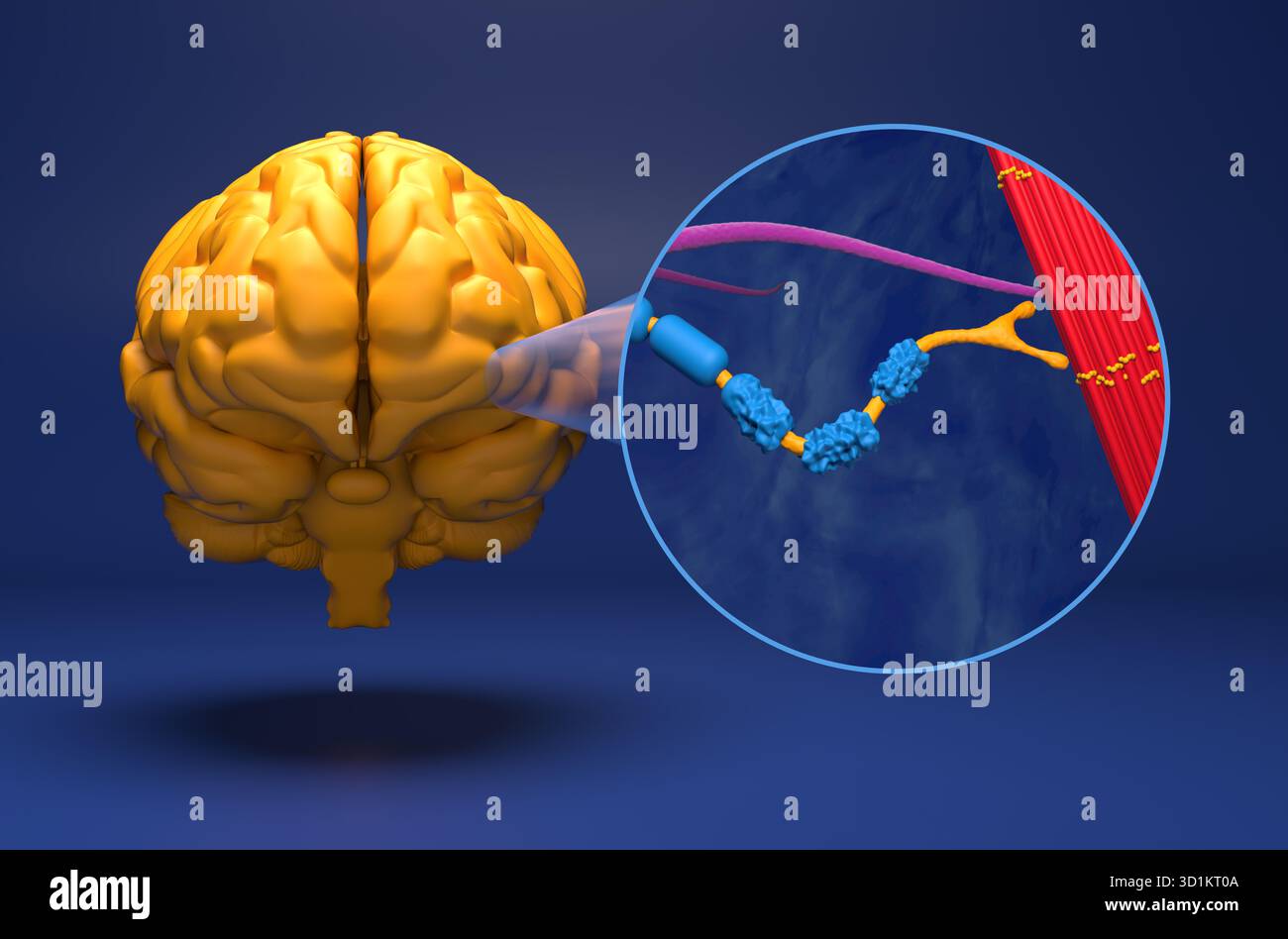 Neurone del motore danneggiato dalla sclerosi laterale amiotrofica (ALS) - Vista ravvicinata dell'illustrazione 3d. Foto Stock