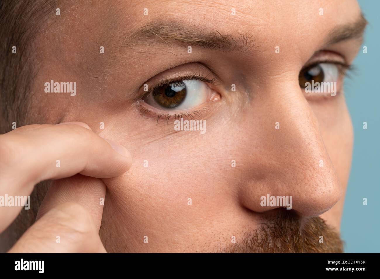 Processo di invecchiamento della pelle del viso. Controllo uomo mirato rughe viso pensare al trattamento cosmetologico in studio Foto Stock