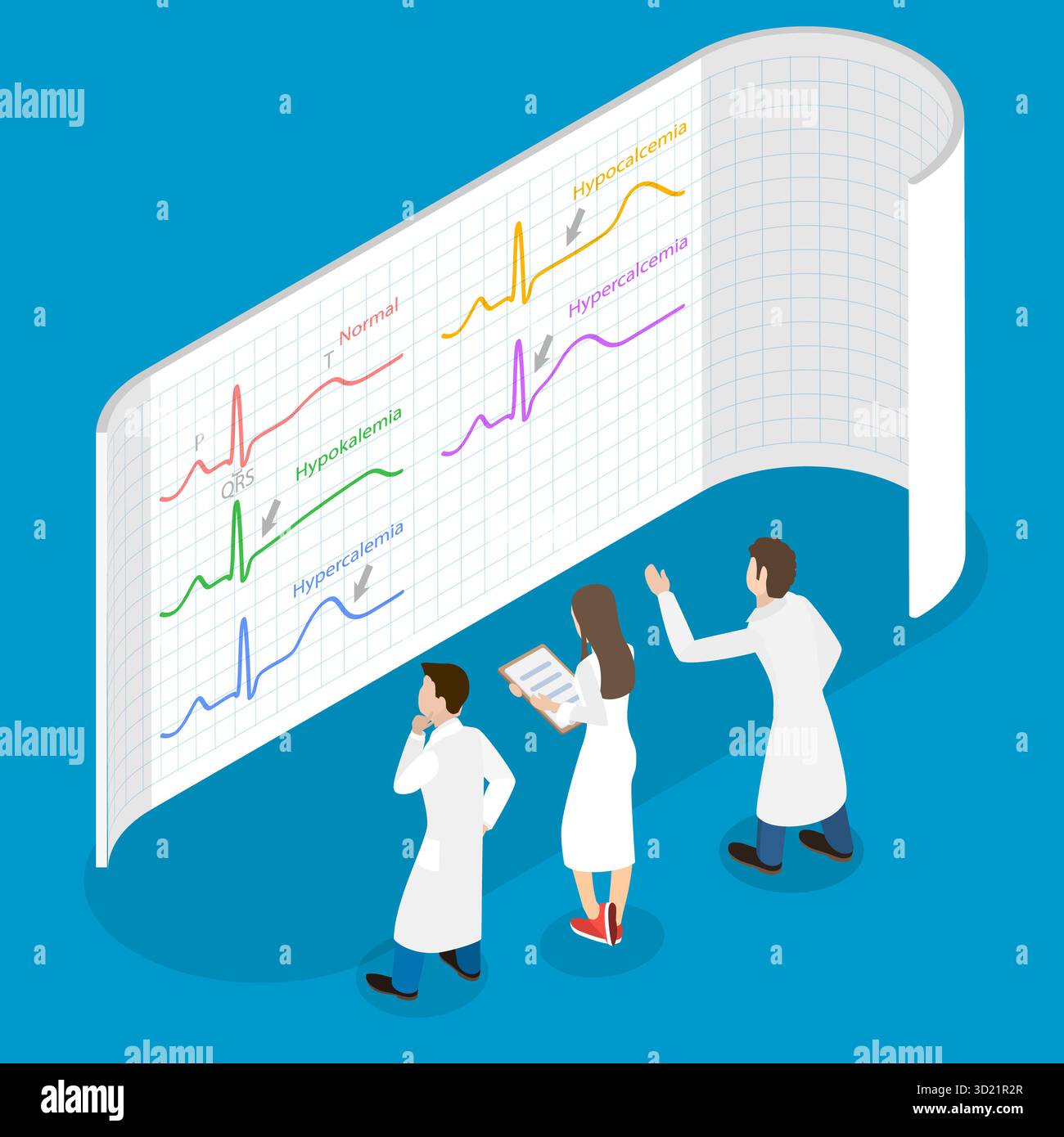 Illustrazione piatta isometrica 3D delle variazioni ECG e dei ritmi cardiaci Foto Stock