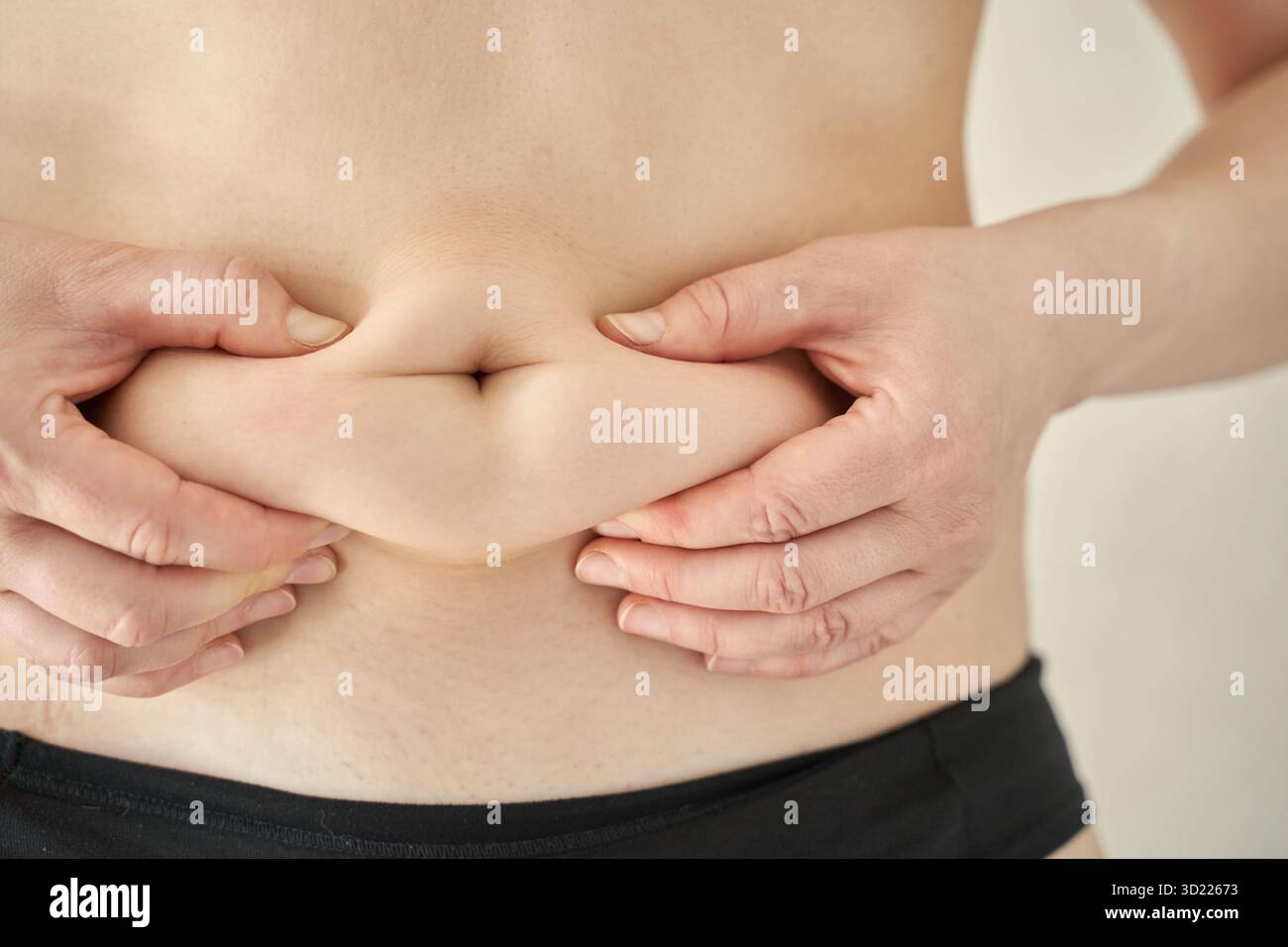 Primo piano di mani che pizzicano la pelle sull'addome maschile visualizzando il grasso corporeo per la salute Foto Stock