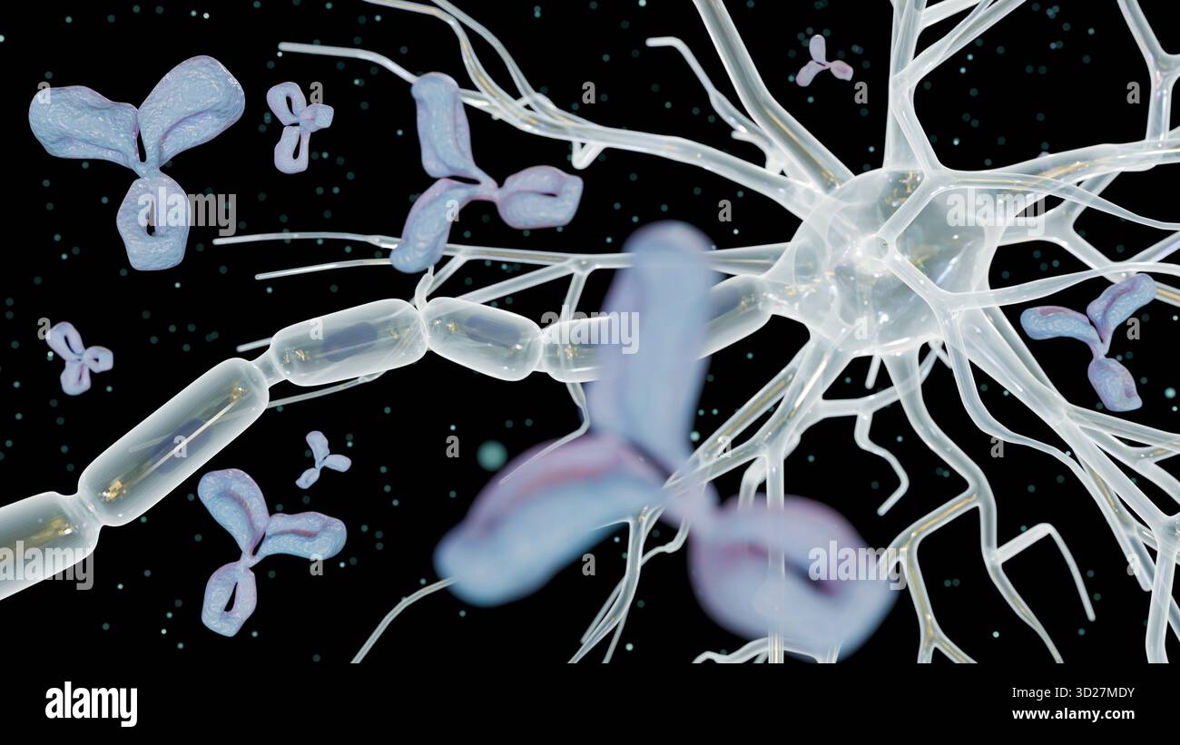 Un'illustrazione 3D raffigura un neurone con i suoi dendriti e l'assone, circondato da numerosi anticorpi rossi a forma di Y Foto Stock