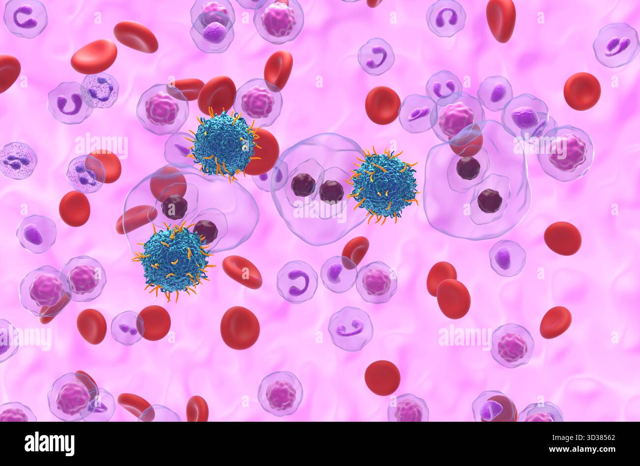 Terapia con cellule T di CAR nel linfoma Hodgkin (HL) - Vista isometrica illustrazione 3d. Foto Stock