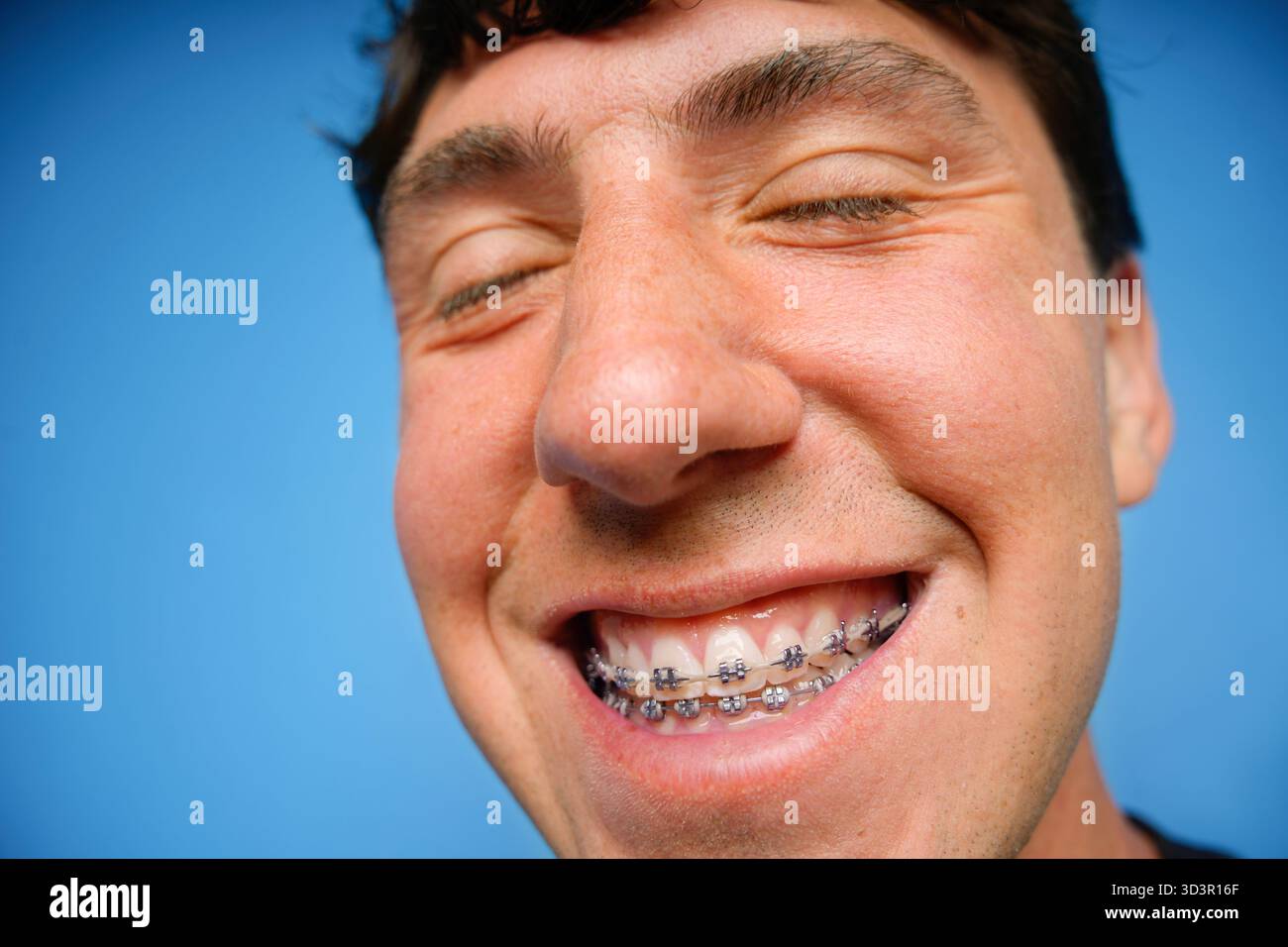 Primo piano di un giovane che sorride gioiosamente, con bretelle, su uno sfondo blu vibrante. L'immagine trasmette un senso di felicità e youthfu Foto Stock