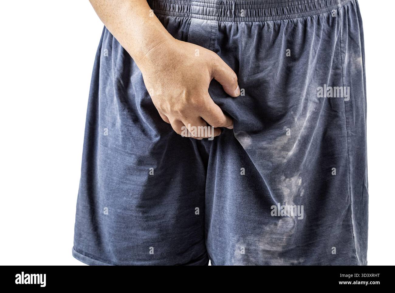 Una persona che indossa pantaloncini scuri è in piedi e tiene il cavallo con una mano, probabilmente indicando disagio. l'immagine viene messa a fuoco sulla parte inferiore del corpo Foto Stock