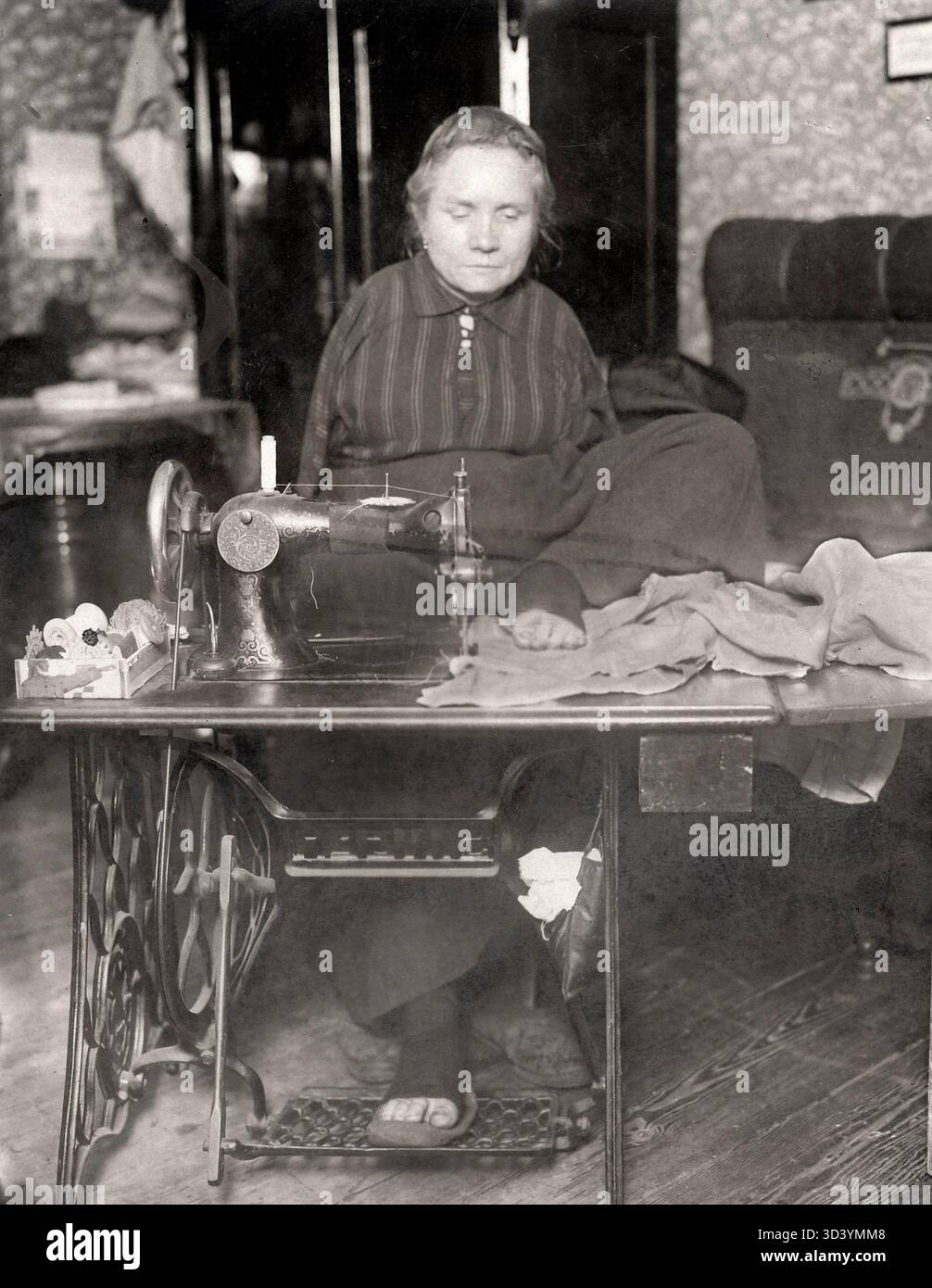 Una donna senza braccia sta usando una macchina da cucire con i piedi a Berlino, in Germania, nel 1926, dimostrando la sua capacità di svolgere compiti che normalmente richiedono le mani. Foto Stock
