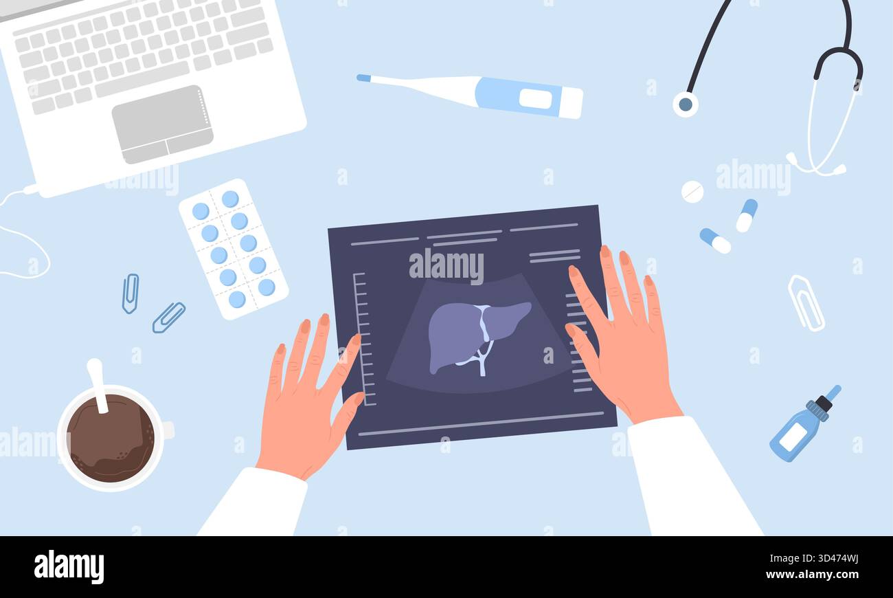 Epatologo che esamina il risultato dell'ecografia epatica per la diagnosi e il trattamento della malattia. Assistenza medica per epatite o cancro. Illustrazione vettoriale cartoni animati Illustrazione Vettoriale