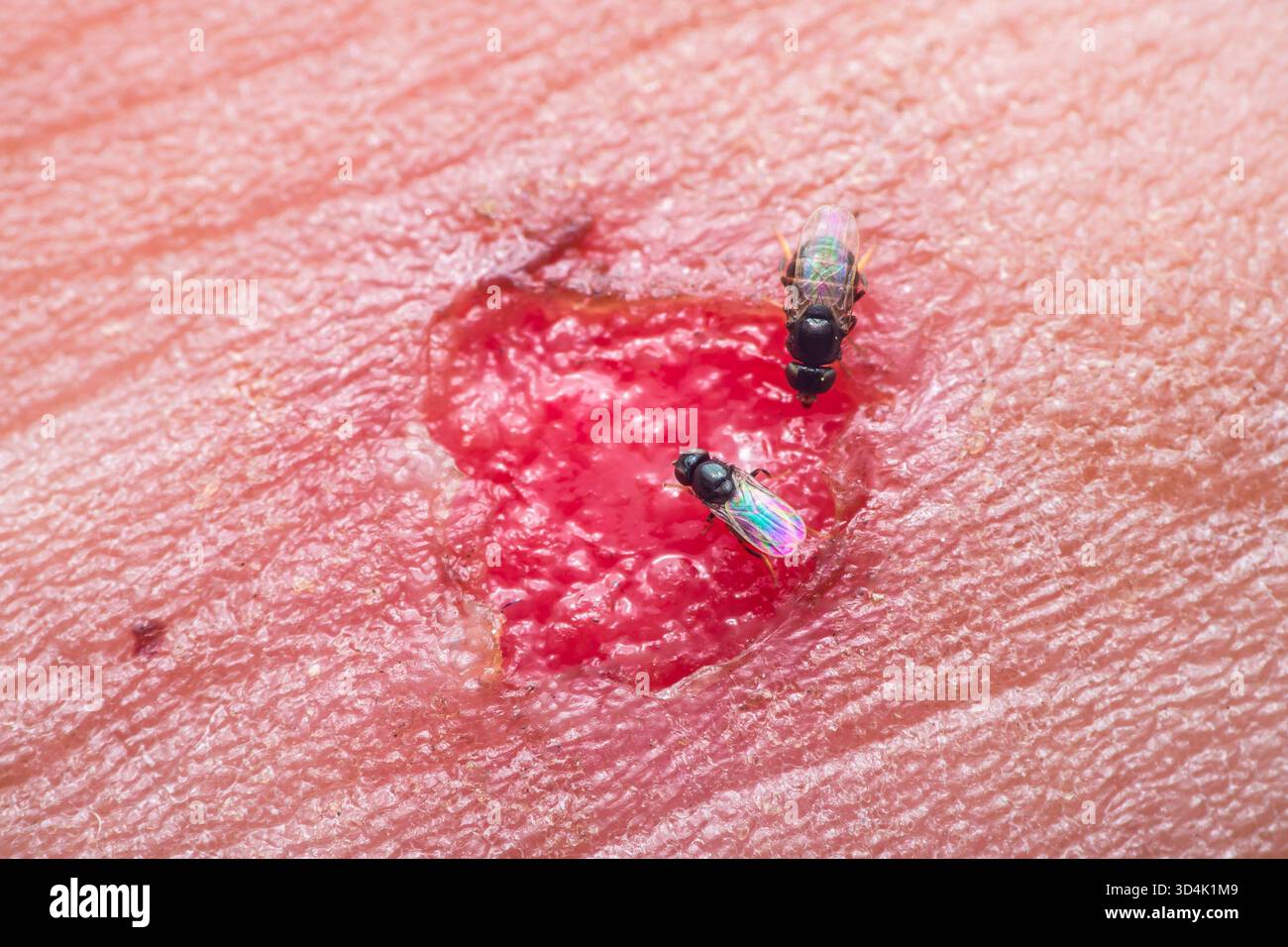 Piccole mosche con ali iridescenti che si nutrono di una ferita umana aperta, che mostra concetti di infezione, decadimento, problemi di salute e insetto beha Foto Stock