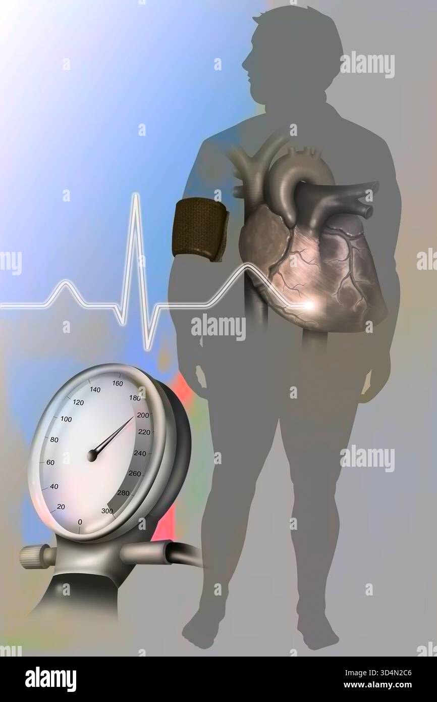 Illustrazione dell'obesità, associata all'ipertensione, come fattore di rischio per le malattie cardiovascolari. Foto Stock