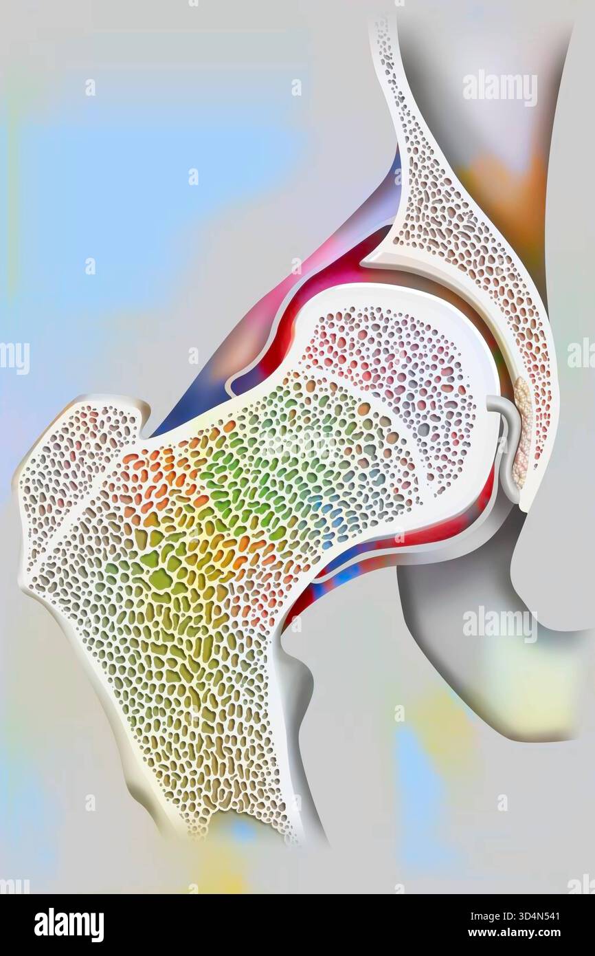 Articolazione co-emorale e collo femorale. Anca 016239 396 Foto Stock