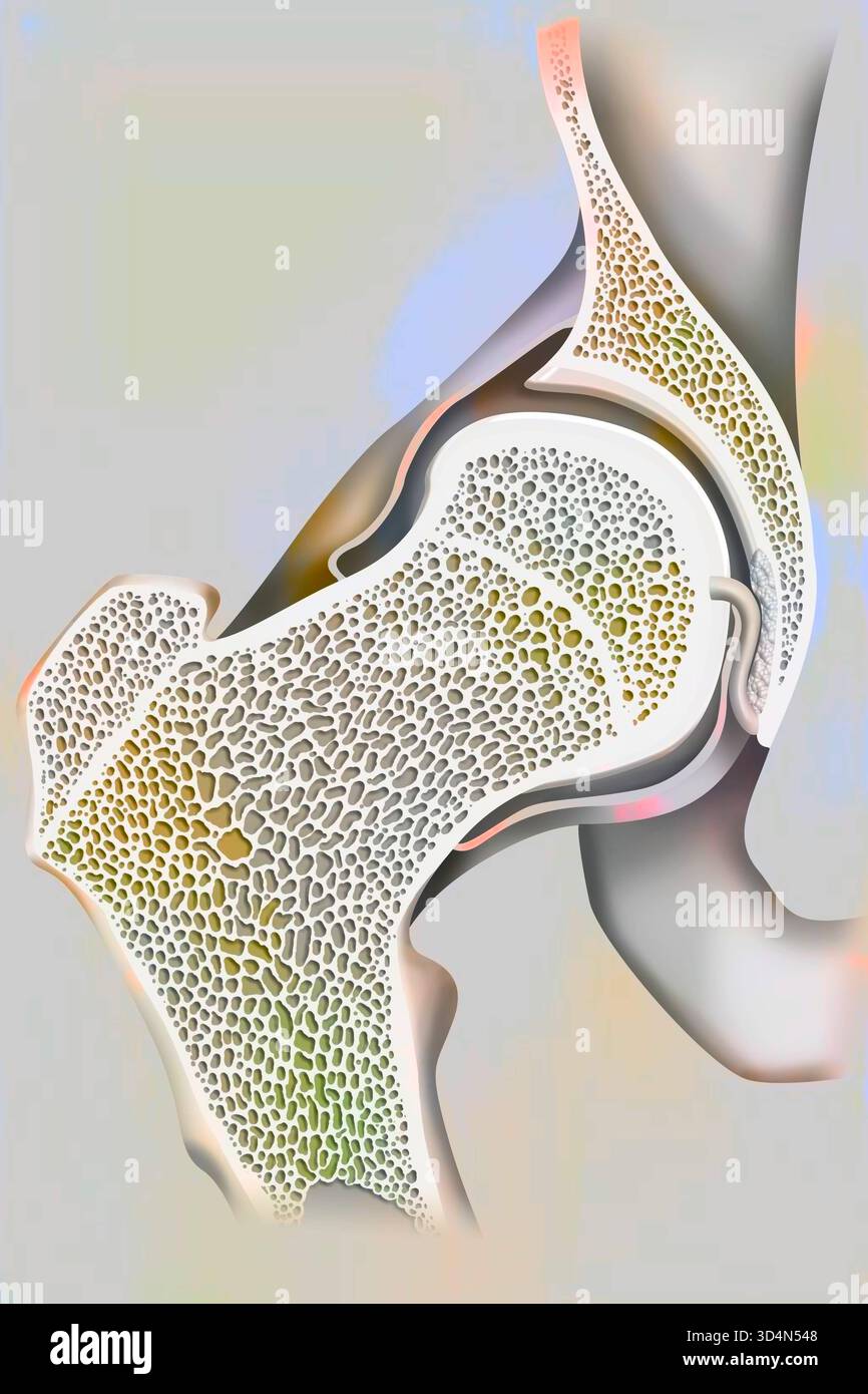 Articolazione co-emorale e collo femorale. Anca 016239 397 Foto Stock
