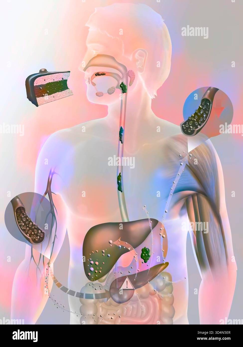 Secrezione di insulina in una persona con diabete di tipo 2. Il diabete di tipo 2 o non insulino-dipendente è una forma di diabete mellito che colpisce principalmente gli adulti Foto Stock