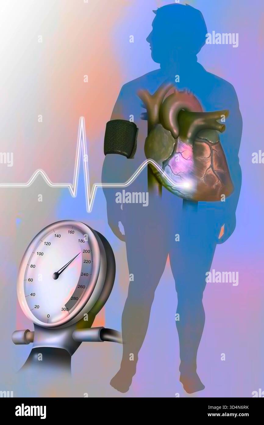 Illustrazione dell'obesità, associata all'ipertensione, come fattore di rischio per le malattie cardiovascolari. Pressione alta 016240 349 Foto Stock