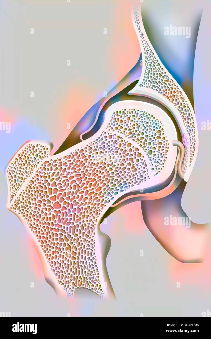 Articolazione co-emorale e collo femorale. Anca 016240 418 Foto Stock