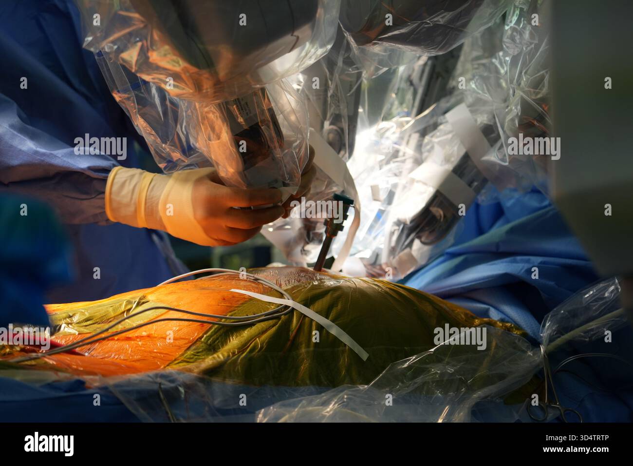 Berlino, Germania. 6 novembre 2025. I professionisti medici operano sul cuore di un paziente con il primo robot chirurgico in chirurgia cardiaca presso il German Heart Center di Charité a Berlino. Crediti: Manuel Genolet/dpa/Alamy Live News Foto Stock