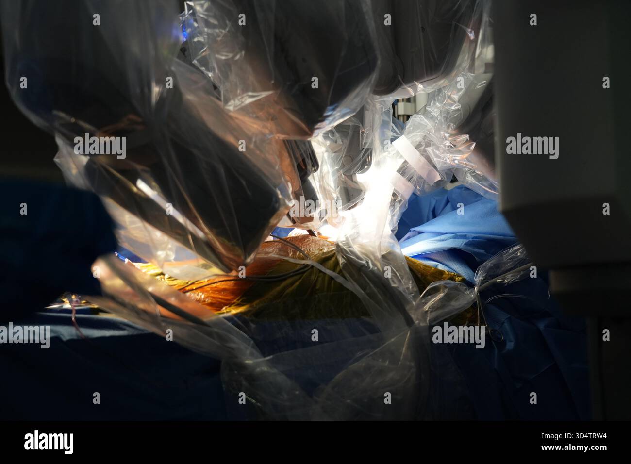 Berlino, Germania. 6 novembre 2025. I professionisti medici operano sul cuore di un paziente con il primo robot chirurgico in chirurgia cardiaca presso il German Heart Center di Charité a Berlino. Crediti: Manuel Genolet/dpa/Alamy Live News Foto Stock