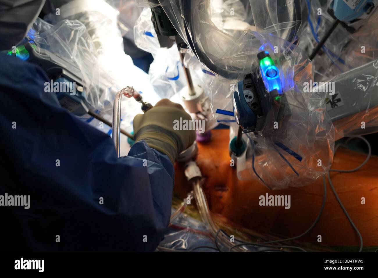 Berlino, Germania. 6 novembre 2025. I professionisti medici operano sul cuore di un paziente con il primo robot chirurgico in chirurgia cardiaca presso il German Heart Center di Charité a Berlino. Crediti: Manuel Genolet/dpa/Alamy Live News Foto Stock