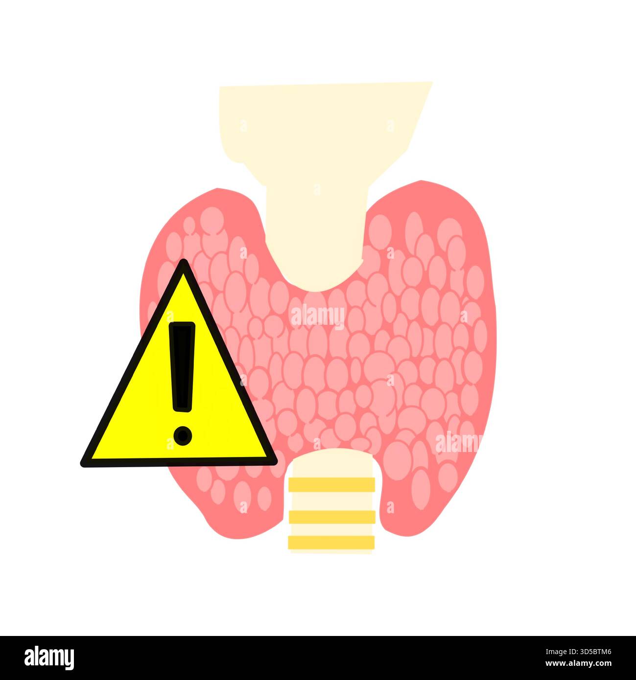 simbolo di pericolo delle ghiandole tiroidee simbolo di avvertimento giallo sulla funzione tiroidea ipotiroidismo ipertiroidismo Illustrazione Vettoriale
