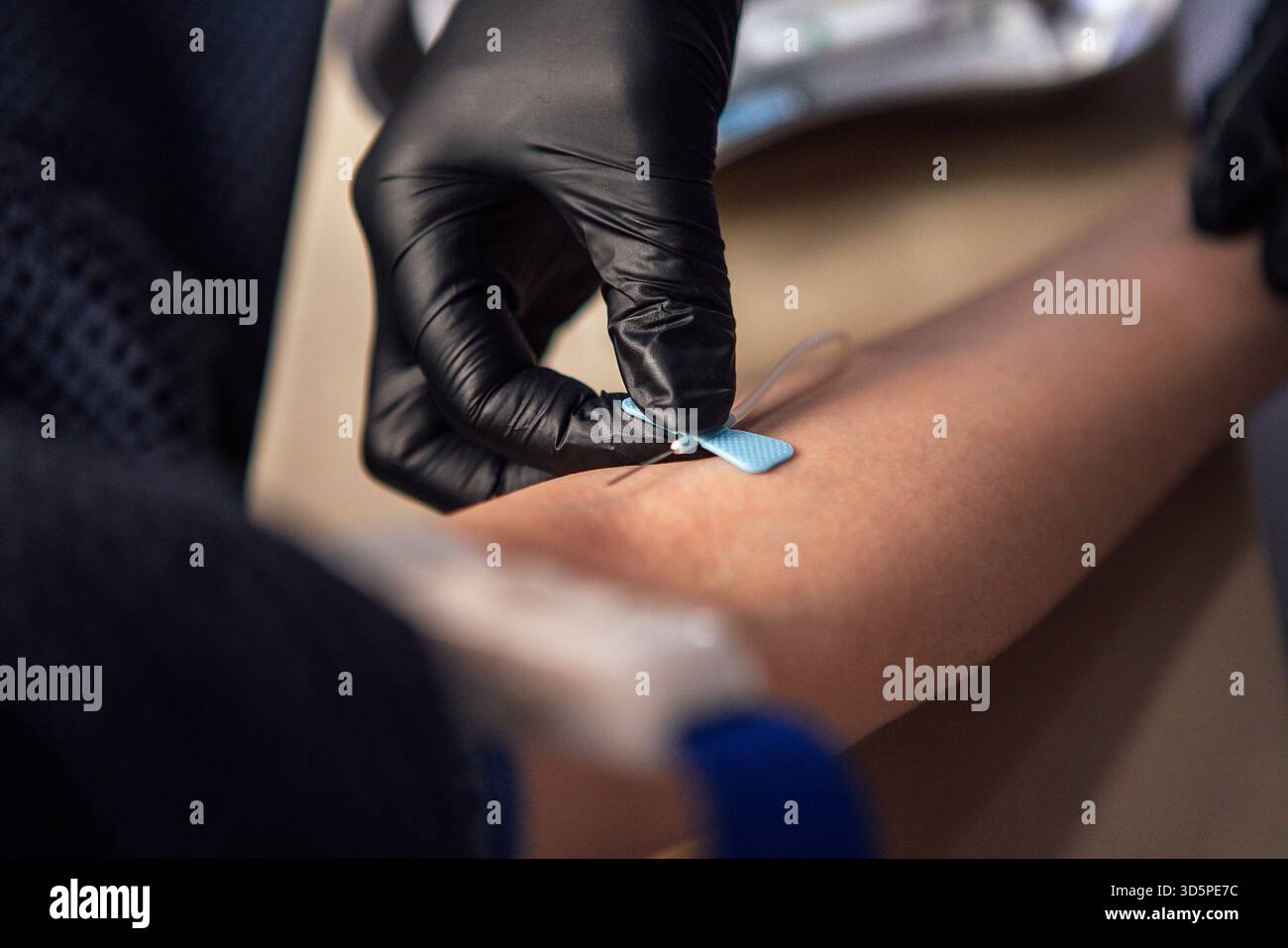 L'operatore sanitario con guanti neri sta ponendo una benda sul braccio di un paziente, evidenziando l'importanza della cura e dell'igiene negli ambienti medici e. Foto Stock