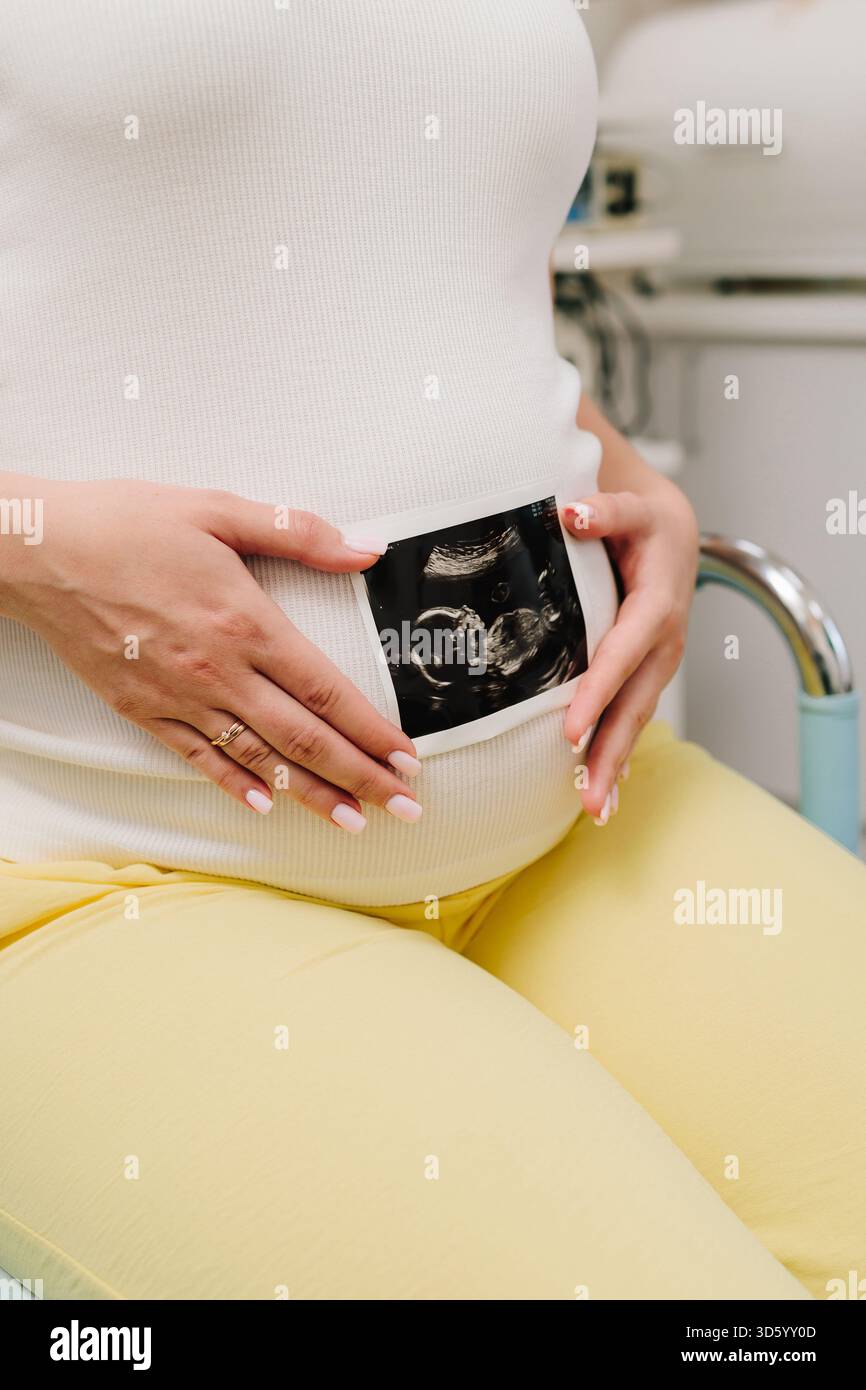 Riprendi momenti preziosi della maternità con un sonogramma. Una donna incinta tiene una foto ecografica del suo bambino sul pancino Foto Stock