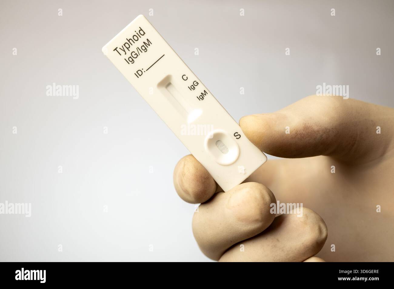 Test al posto letto che mostra le finestre IgG/IgM per il rilevamento degli anticorpi Salmonella typhi. Foto Stock