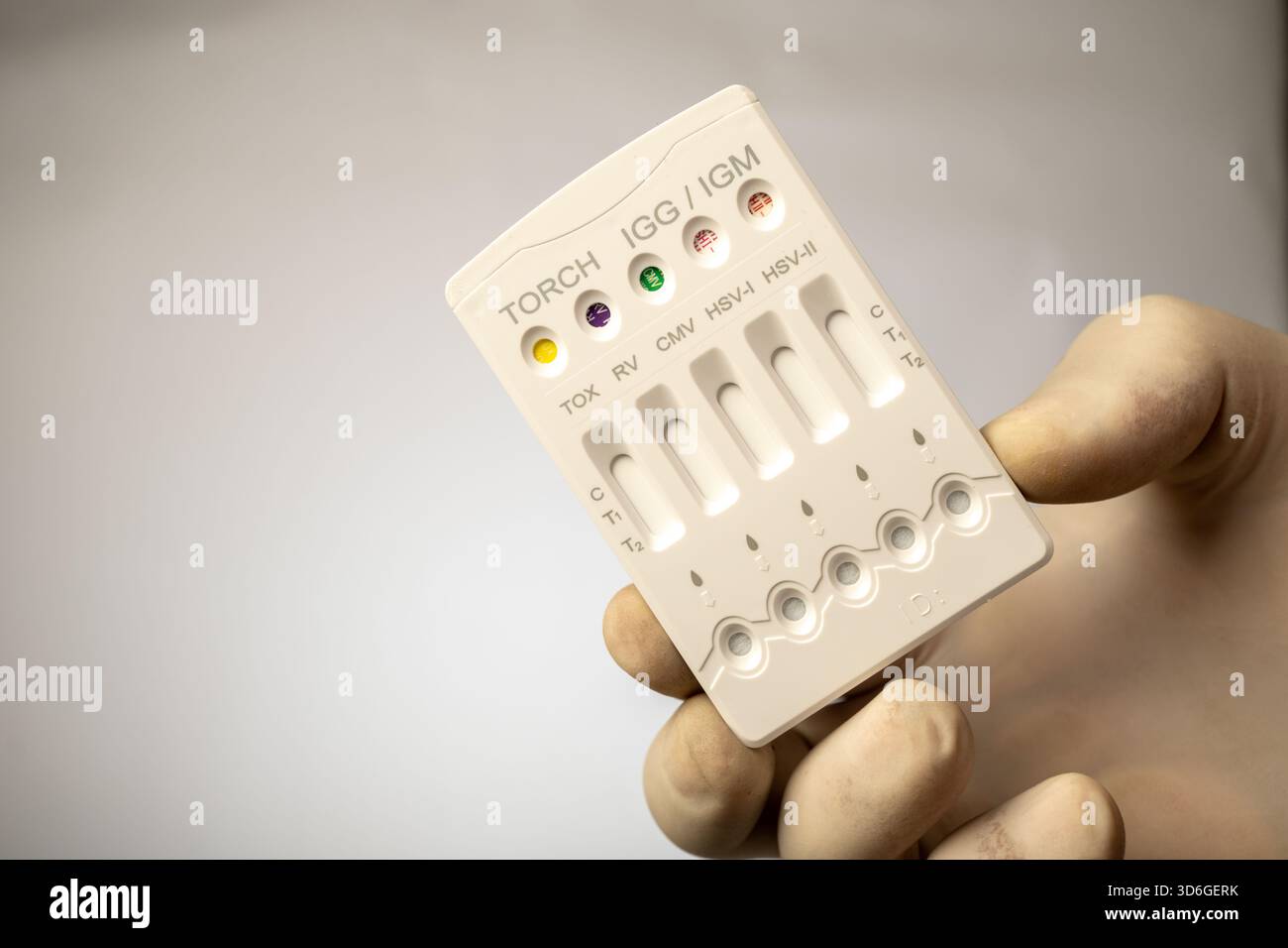 Dosaggio immunocromatografico: Rilevamento rapido di anticorpi IgG e IgM per infezioni congenite. Foto Stock