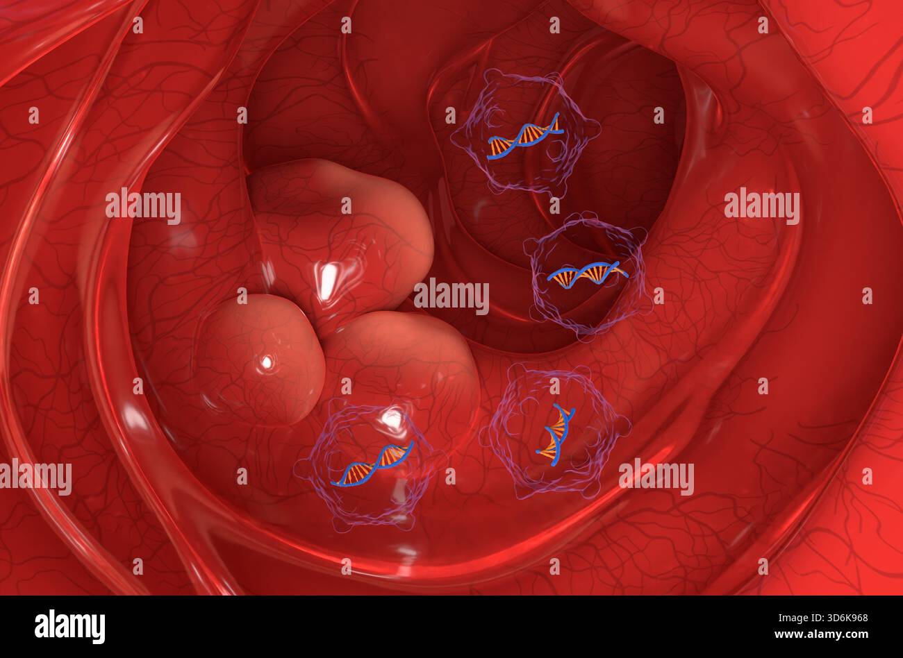 Terapia genica nel colon, cancro colorettale (CRC) - Vista in sezione illustrazione 3d. Foto Stock