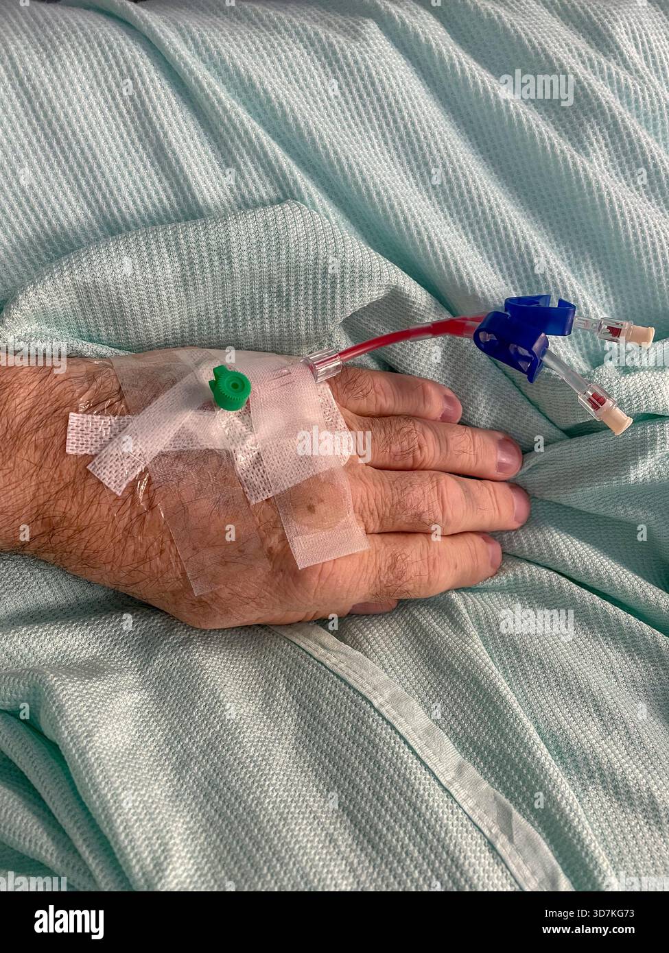 Paziente di sesso maschile anziano con cannula per via endovenosa inserita nella mano sinistra nel reparto ospedaliero: Phillip Roberts - Immagine stock catturata con smartphone