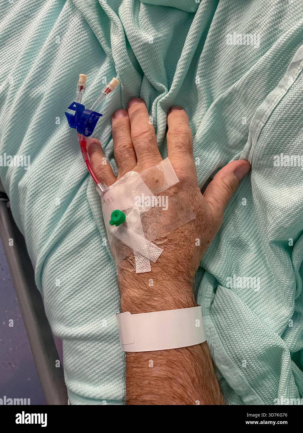 Paziente di sesso maschile anziano con cannula per via endovenosa inserita nella mano sinistra nel reparto ospedaliero: Phillip Roberts - Immagine stock catturata con smartphone