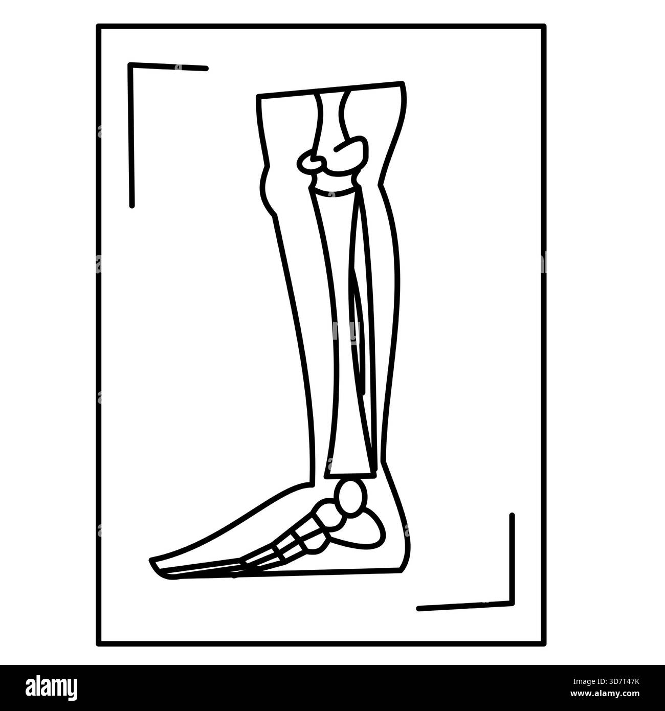 gamba radiologia raggi x ossa delle gambe contorno dell'icona medica linea icona Illustrazione Vettoriale