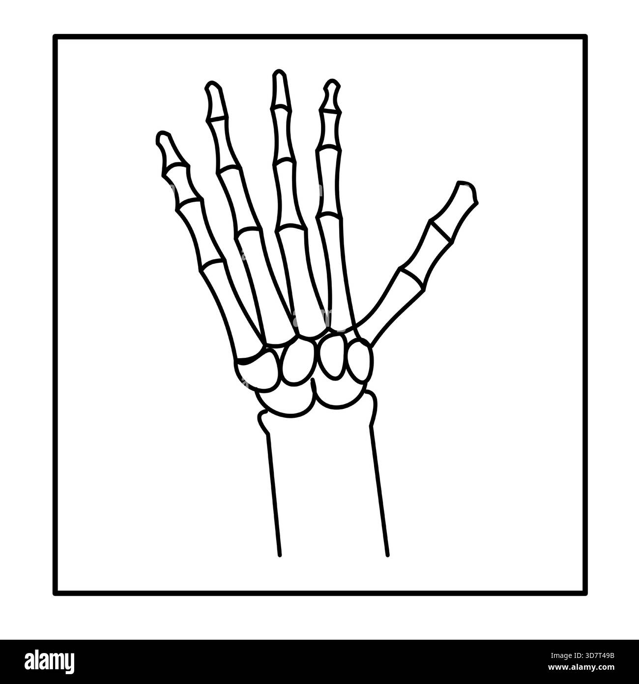 ossa delle mani ossa delle mani ossa carpale a raggi x icona medica radiologia Illustrazione Vettoriale