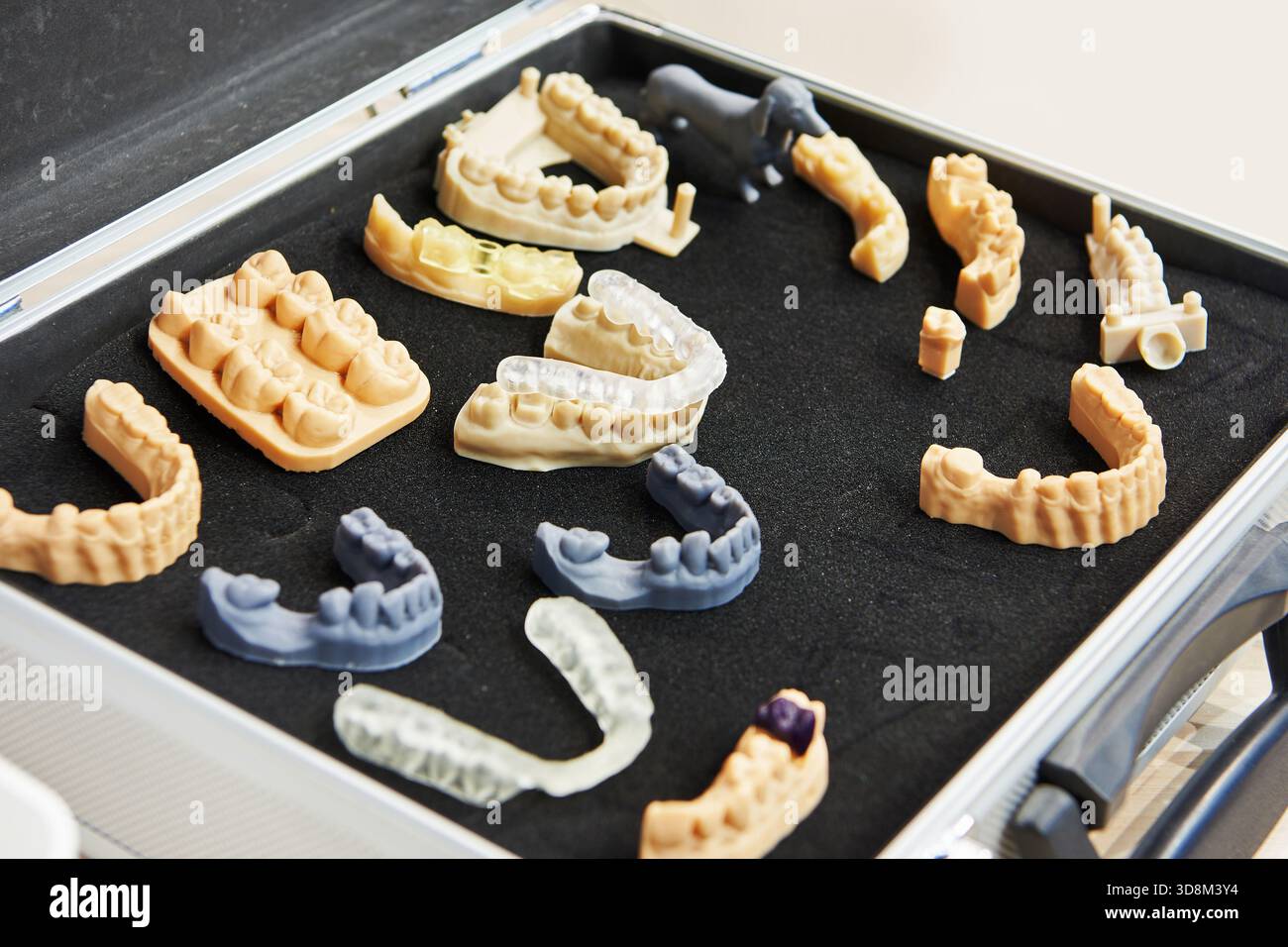 Impronte di denti su uno scanner 3D dentale Foto Stock